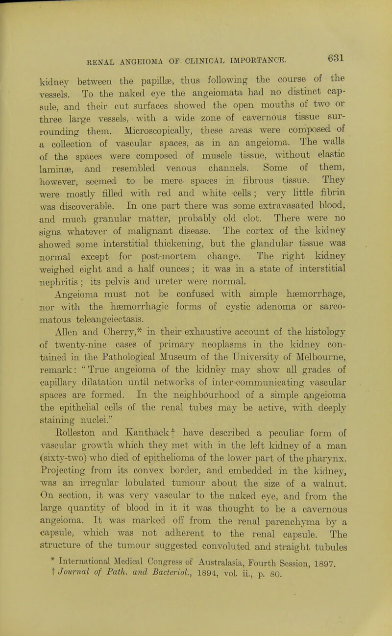 RENAL ANGEIOMA OF CLINICAL IMPORTANCE. kidney between the papillae, thus following the course of the vessels. To the naked eye the angeiomata had no distinct cap- sule, and their cut surfaces showed the open mouths of two or tlii-ee large vessels, with a wide zone of cavernous tissue sur- rounding them. Microscopically, these ai-eas were composed of a collection of vascular spaces, as in an angeioma. The walls of the spaces were composed of muscle tissue, without elastic laminae, and resembled venous channels. Some of them, however, seemed to be mere spaces in fibrous tissue. They were mostly filled with red and white cells; very little fibrin was discoverable. In one pai-t there was some extravasated blood, and much granular matter, probably old clot. There were no signs whatever of malignant disease. The cortex of the kidney showed some interstitial thickening, but the glandular tissue was normal except for post-mortem change. The right kidney weighed eight and a half ounces; it was in a state of interstitial nephritis ; its pelvis and ureter were normal. Angeioma must not be confused with simple haemorrhage, nor with the haemorrhagic forms of cystic adenoma or sarco- matous teleangeiectasis. Allen and Cherry,* in their exhaustive account of the histology of twenty-nine cases of primary neoplasms in the kidney con- tained in the Pathological Museum of the University of Melbourne, remark: True angeioma of the kidney may show all grades of capillary dilatation until networks of inter-commtmicating vascular spaces are formed. In the neighbourhood of a simple angeioma the epithelial cells of the renal tubes may be active, with deeph' stainmg nuclei. RoUeston and Kanthackf have described a peculiar form of A'ascular growth which they met with in the left kidney of a man (sixty-two) who died of epithelioma of the lower part of the pharynx. Pi-ojecting from its convex border, and embedded in the kidney, Avas an irregular lobulated tumour about the size of a wahiut. On section, it was very vascular to the naked eye, and from the large quantity of blood in it it was thought to be a cavernous angeioma. It was marked ofit from the renal parenchyma by a capsule, which was not adherent to the renal capsule. The structui-e of the tumour suggested convoluted and straight tubules * International Medical Congress of Australasia, Fourth Session, 1897. ^Journal of Path, and Bacteriol., 1894, vol. ii., p. 80.