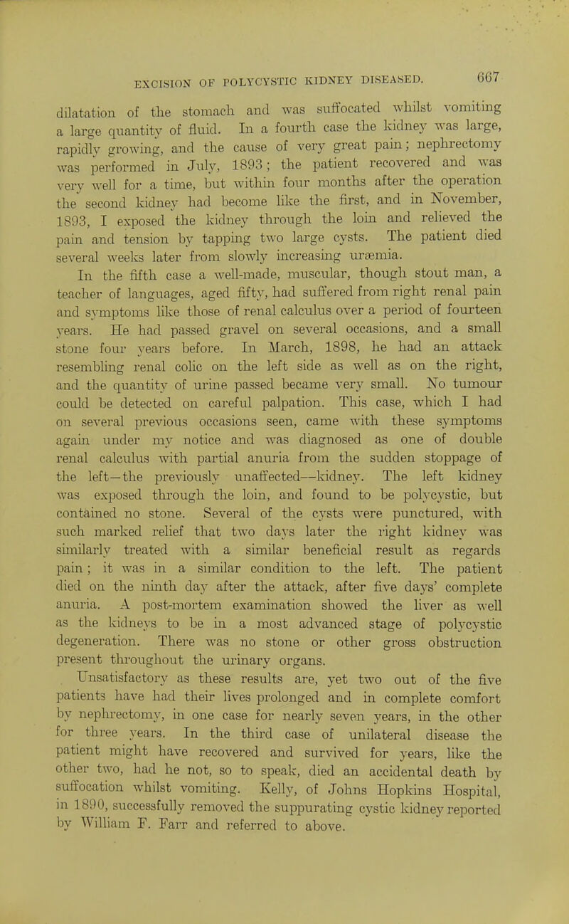 dilatation of the stomach and was suffocated whilst vomiting a large quantity of fluid. In a fourth case the kidney was large, rapidly growing, and the cause of very great pain; nephrectomy was performed in July, 1893; the patient recovered and was very well for a time, but withm four months after the operation the' second kidney had become like the first, and in November, 1893, I exposed the kidney through the lorn and relieved the pain and tension by tapping two large cysts. The patient died several weeks later from slowly increasing uraemia. In the fifth case a well-made, muscular, though stout man, a teacher of languages, aged fifty, had suffered from right renal pain and symptoms like those of renal calculus over a period of fourteen years. He had passed gravel on several occasions, and a small stone four 3-ears before. In March, 1898, he had an attack resembling renal colic on the left side as well as on the right, and the quantity of urine passed became very small. No tumour could be detected on careful palpation. This case, which I had on several previous occasions seen, came with these symptoms again under my notice and was diagnosed as one of double renal calculus with partial anuria from the sudden stoppage of the left—the previously unaft'ected—kidney. The left kidney was exposed through the loin, and found to be polycystic, but contained no stone. Several of the cysts were punctured, with such marked relief that two days later the I'ight kidney was similarly treated with a similar beneficial result as regards pain; it was in a similar condition to the left. The patient died on the ninth day after the attack, after five days' complete anuria. A post-mortem examination showed the liver as well as the kidneys to be in a most advanced stage of polycystic degeneration. There was no stone or other gross obstruction present tlu-oughout the urinary organs. Unsatisfactory as these results are, yet two out of the five patients have had their lives prolonged and in complete comfort by neplu-ectomy, in one case for nearly seven years, in the other for three years. In the third case of unilateral disease the patient might have recovered and survived for years, like the other two, had he not, so to speak, died an accidental death by suffocation whilst vomiting. Kelly, of Johns Hopkins Hospital, m 1890, successfully removed the suppurating cystic kidney reported by William F. Farr and referred to above.