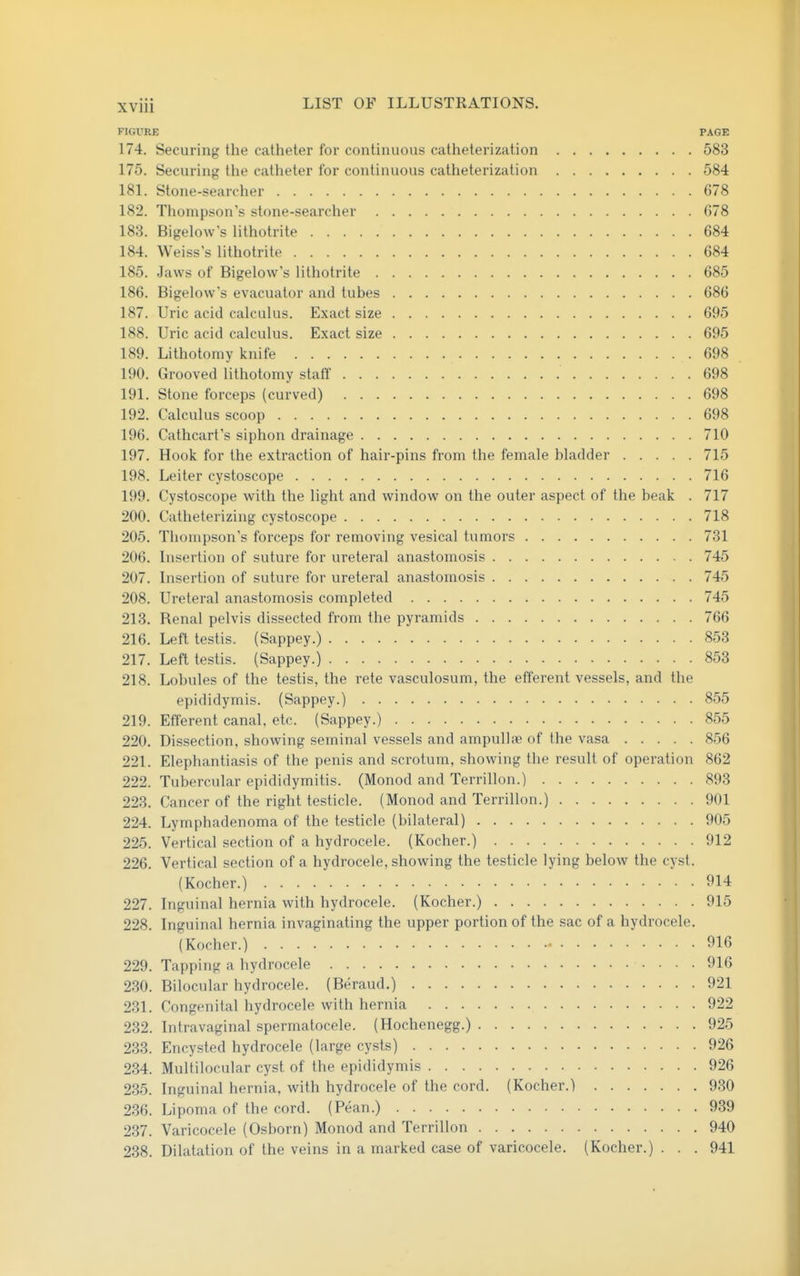 FIGURE PAGE 174. Securing the catheter for continuous catheterization 583 175. Securing the catheter for continuous catheterization 584 181. Stone-searcher 678 182. Thompson's stone-searcher 678 183. Bigelow's lithotrite 684 184. Weiss s lithotrite 684 185. Jaws of Bigelow's lithotrite 685 186. Bigelow's evacuator and tubes 686 187. Uric acid calculus. Exact size 695 188. Uric acid calculus. Exact size 695 189. Lithotomy knife 698 190. Grooved lithotomy staff 698 191. Stone forceps (curved) 698 192. Calculus scoop 698 196. Cathcart's siphon drainage 710 197. Hook for the extraction of hair-pins fi'om the female bladder 715 198. Leiter cystoscope 716 199. Cystoscope with the light and window on the outer aspect of the beak . 717 200. Catheterizing cystoscope 718 205. Thompson's forceps for removing vesical tumors 731 206. Insertion of suture for ureteral anastomosis 745 207. Insertion of suture for ureteral anastomosis 745 208. Ureteral anastomosis completed 745 213. Renal pelvis dissected from the pyramids 766 216. Left testis. (Sappey.) 853 217. Left testis. (Sappey.) 853 218. Lobules of the testis, the rete vasculosum, the efferent vessels, and the epididymis. (Sappey.) 855 219. Efferent canal, etc. (Sappey.) 855 220. Dissection, showing seminal vessels and ampullae of the vasa 856 221. Elephantiasis of the penis and scrotum, showing the result of operation 862 222. Tubercular epididymitis. (Monod and Terrillon.) 893 223. Cancer of the right testicle. (Monod and Terrillon.) 901 224. Lymphadenoma of the testicle (bilateral) 905 225. Vertical section of a hydrocele. (Kocher.) 912 226. Vertical section of a hydrocele, showing the testicle lying below the cyst. (Kocher.) 914 227. Inguinal hernia with hydrocele. (Kocher.) 915 228. Inguinal hernia invaginating the upper portion of the sac of a hydrocele. (Kocher.) - 916 229. Tapping a hydrocele 916 230. Bilocular hydrocele. (Beraud.) 921 231. Congenital hydrocele with hernia 922 232. Intravaginal spermatocele. (Hochenegg.) 925 233. Encysted hydrocele (large cysts) 926 234. Multilocular cyst of the epididymis 926 235. Inguinal hernia, with hydrocele of the cord. (Kocher.) 930 236. Lipoma of the cord. (Pean.) 939 237. Varicocele (Osborn) Monod and Terrillon 940 238. Dilatation of the veins in a marked case of varicocele. (Kocher.) ... 941