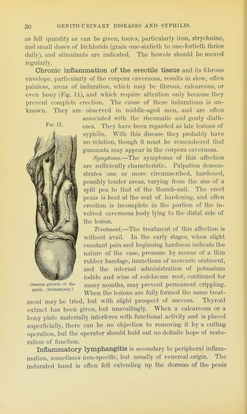 Fig. 11. as full quantity as can be given, tonics, particularly iron, strychnine, and small doses of bichloride (grain one-sixtieth to one-fortieth thrice daily), and stimulants are indicated. The bowels should be moved regularly. Chronic inflammation of the erectile tissue and its fibrous envelope, particularly of the corpora cavernosa, results in slow, often painless, areas of induration, which may be fibrous, calcareous, or even bony (Fig. 11), and which require attention only because they prevent complete erection. The cause of these indurations is un- known. They are observed in middle-aged men, and are often associated with the rheumatic and gouty diath- eses. They have been regarded as late lesions of syphilis. With this disease they probably have no relation, though it must be remembered that gummata may appear in the corpora cavernosa. Symptoms.—The symptoms of this affection are sufficiently characteristic. Palpation demon- strates one or more circumscribed, hardened, possibly tender areas, varying from the size of a split pea to that of the thumb-nail. The erect penis is bent at the seat of hardening, and often erection is incomplete in the portion of the in- volved cavernous body lying to the distal side of the lesion. Treatment.—The treatment of this affection is without avail. In the early stages, when slight constant pain and beginning hardness indicate the nature of the case, pressure by means of a thin rubber bandage, inunctions of mercuric ointment, and the internal administration of potassium iodide and wine of colchicum root, continued for many months, may prevent permanent crippling. When the lesions are fully formed the same treat- ment may be tried, but with slight prospect of success. Thyroid extract has been given, but unavailingly. When a calcareous or a bony plate materially interferes with functional activity and is placed superficially, there can be no objection to removing it by a cutting operation, but the operator should hold out no definite hope of resto- ration of function. Inflammatory lymphangitis is secondary to peripheral inflam- mation, sometimes non-specific, but usually of venereal origin. The indurated band is often felt extending up the dorsum of the penis Osseous growth of the penis. (Demarquay.)