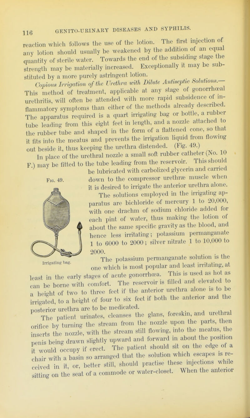 reaction which foHows the use of the lotion. The first injection of anv lotion should usually be weakened by the addition of an equal quantity of sterile water. Towards the end of the subsiding stage the strength may be materially increased. Exceptionally it may be sub- stituted by a more purely astringent lotion. Copious Irrigation of the Urdlwa with Dilute Antiseptic .Solutions.— This method of treatment, applicable at any stage of gonorrhcBal urethritis, will often be attended with more rapid subsidence of in- flammatory symptoms than either of the methods already described. The apparatus required is a quart irrigating bag- or bottle a rubber tube leading from this eight feet in length, and a nozzle attached to the rubber tube and shaped in the form of a flattened cone, so that it fits into the meatus and prevents the irrigation liquid from flowing out beside it, thus keeping the urethra distended. (Fig. 49 ) In place of the urethral nozzle a small soft rubber catheter (No. 10 F ) may be fitted to the tube leading from the reservoir. This should be lubricated with carbolized glycerin and carried Fig. 49. down to the compressor urethrse muscle when it is desired to irrigate the anterior urethra alone. The solutions employed in the irrigating ap- paratus are bichloride of mercury 1 to 20,000, with one drachm of sodium chloride added for each pint of water, thus making the lotion of about the same specific gravity as the blood, and hence less irritating; potassium permanganate 1 to 6000 to 2000; silver nitrate 1 to 10,000 to 2000. . . The potassium permanganate solution is the one which is most popular and least irritating, at least in the early stages of acute gonorrhoea. This is used as hot as can be borne with comfort. The reservoir is filled and elevated to a height of two to three feet if the anterior urethra alone is to be irrigated, to a height of four to six feet if both the anterior and the posterior urethra are to be medicated. The patient urinates, cleanses the glans, foreskm, and urethral orifice by turning the stream from the nozzle upon the parts, then inserts the nozzle, with the stream still flowing, into the meatus, the penis being drawn slightly upward and forward in about the position ft would occupy if erect. The patient should sit on the edge of a chair with a basin so arranged that the solution which escapes is re- ceived in it, or, better still, should practise these injections while i^ng on th; seat of a commode or water-closet. When the anterior Irrigating bag.