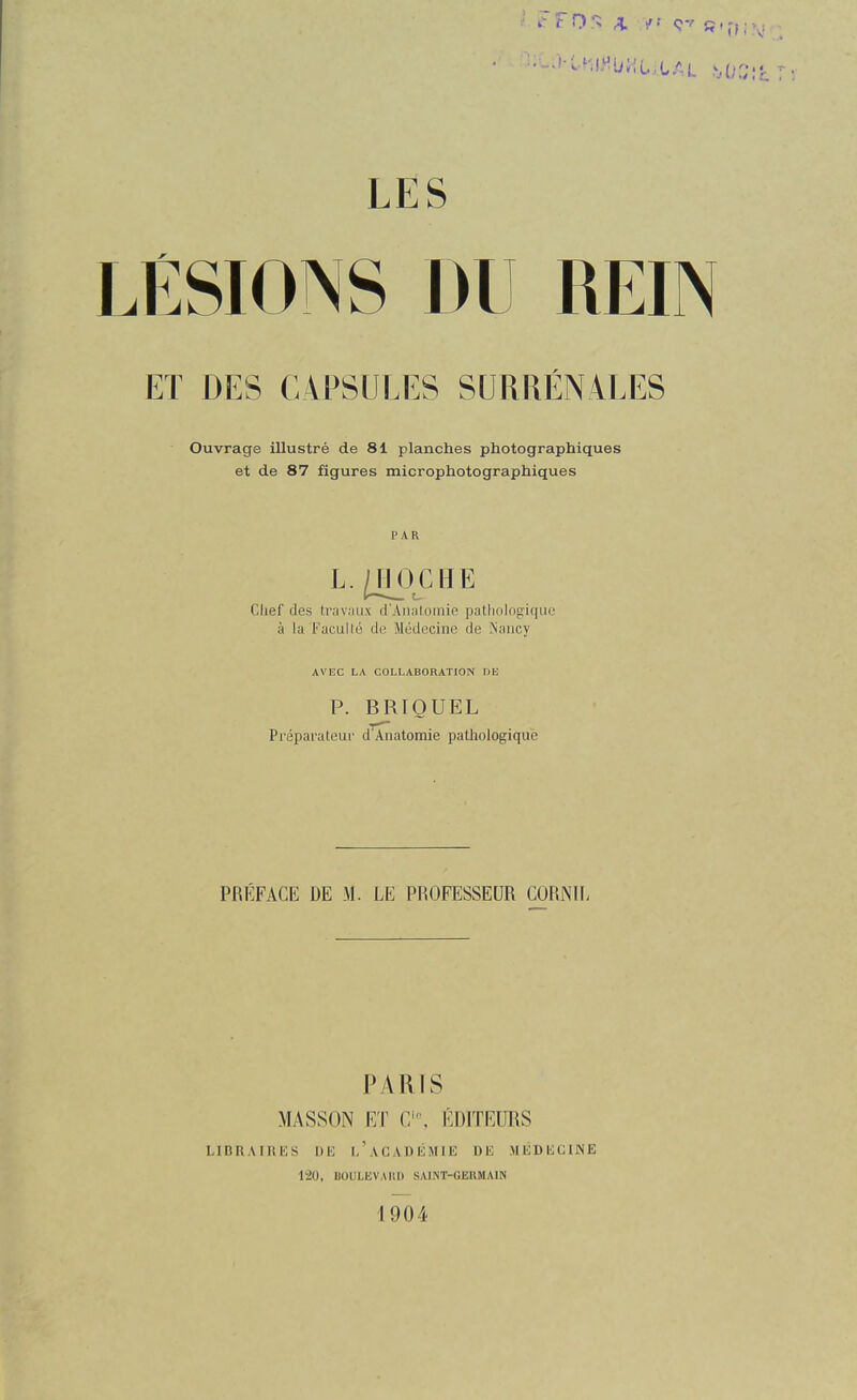 LÉSIONS DU REIN ET DES CAPSULES SURRÉNALES Ouvrage illustré de 81 planches photographiques et de 87 figures microphotographiques PAR L.^JOCHE Clief des lr;iv;iux d'Aiiiiloinie palliologiciue à la Fucullé du Médecine de Nancy AVEC LA COLLABORATION Dli P. BRIOUEL Préparateur d^Anatomie pathologique PRÉFACE DE M. LE PROFESSEUR CORNIL PARIS MASSON ET C:% ÉDITEURS LIBRAIRES 1)10 I,'ACADÉMIE DE MÉDECINE 120, BOULEVAIiD SAINT-GEKMAIN 1904