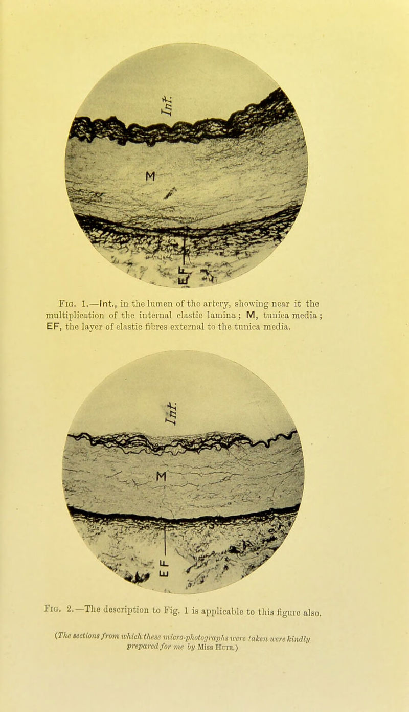 Fig. 1.—Int., iu the lumen of tlie artery, showing near it the multiplication of the internal elastic lamina; M, tunica media; EF, the layer of elastic fibres external to the tunica media. {The sections from which these micfo-photodmiihswerc taken tcore kindly prepared for me by Miss IIuie.)