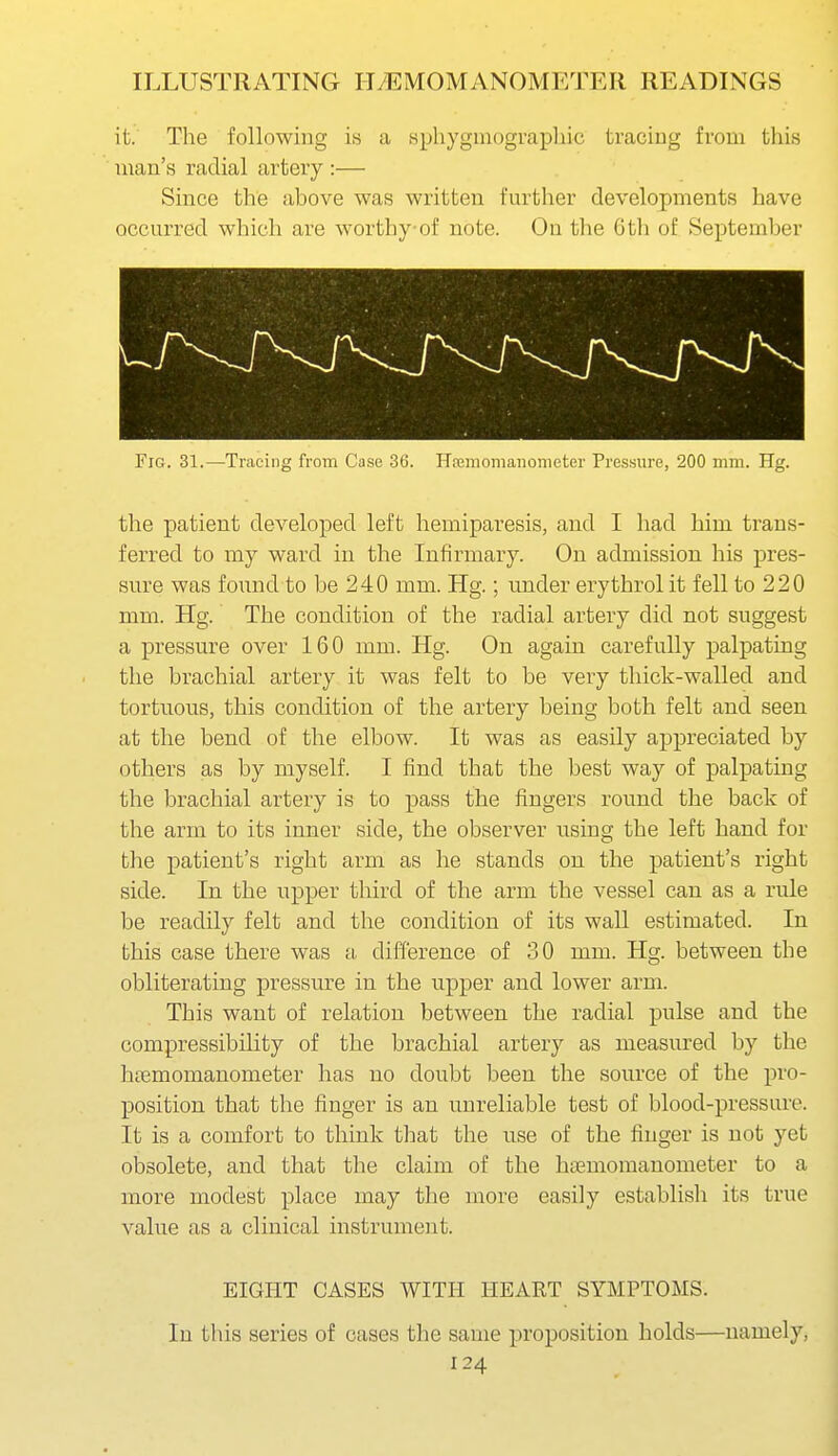 it. The following is a Hphyginographic tracing from this man's radial artery :— Since the above was written further developments have occurred which are worthy of note. On tlie Gtli of September Fig. 31.—Tracing from Case 36. Hnemomanometer Pressure, 200 mm. Hg. the patient developed left hemiparesis, and I had him trans- ferred to my ward in the Infirmary. On admission his pres- sure was found to be 240 mm. Hg.; under erythrol it fell to 220 mm. Hg. The condition of the radial artery did not suggest a pressure over 160 mm. Hg. On again carefully palpating the brachial artery it was felt to be very thick-walled and tortnous, this condition of the artery being both felt and seen at the bend of the elbow. It was as easily appreciated by others as by myself. I find that the best way of palpating the brachial artery is to pass the fingers round the back of the arm to its inner side, the observer using the left hand for the patient's right arm as he stands on the patient's right side. In the upper third of the arm the vessel can as a rule be readily felt and the condition of its wall estimated. In this case there was a difference of 30 mm. Hg. between the obliterating pressure in the upper and lower arm. This want of relation between the radial pulse and the compressibility of the brachial artery as measured by the htemomanometer has no doubt been the source of the pro- position that the finger is an unreliable test of blood-pressure. It is a comfort to think that the use of the finger is not yet obsolete, and that the claim of the hismomanometer to a more modest place may the more easily establisli its true value as a clinical instrument. EIGHT CASES WITH HEART SYMPTOMS. In this series of cases the same proposition holds—namely,