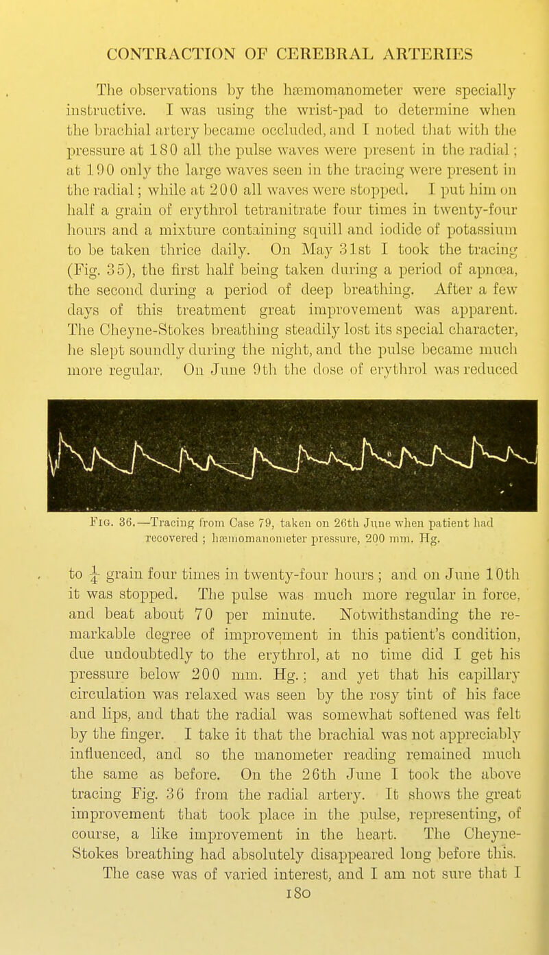 The observations by the litemomanometer were specially instructive. I was using the wrist-pad to determine when the brachial artery became occluded, and T noted that with the pressure at 180 all t]ie pulse waves were ]jresent in the radial; at 190 only the large waves seen in the tracing were present in the radial; while at 200 all waves were st(jpped. I put him on half a grain of erythrol tetranitrate four times in twenty-four hours and a mixture containing squill and iodide of potassium to be taken thrice daily. On May 31st I took the tracing (Fig. 35), the first half being taken during a period of apncea, the second during a period of deep breathing. After a few days of this treatment great improvement was apparent. The Cheyne-Stokes breathing steadily lost its special character, he slept soundly during the night, and the pulse became much more regular. On June 9tli the dose of erythrol was reduced Fig. 36.—Tracing from Case 79, taken on 26th June when patient had recovered ; hfeiiiomanonieter pressure, 200 mm. Hg. to ^ grain four times in twenty-four hours ; and on Jime 10th it was stopped. Tlie pulse was much more regular in force, and beat about 70 per minute. Notwithstanding the re- markable degree of improvement in this patient's condition, due undoubtedly to the erythrol, at no time did I get his pressure below 200 mm. Hg.; and yet that his capillary circulation was relaxed was seen by the rosy tint of his face and lips, and that the radial was somewhat softened was felt by the finger. I take it that tlie brachial was not appreciably influenced, and so the manometer reading remained mucli the same as before. On the 26th June I took the above tracing Fig. 36 from the radial artery. It shows the great improvement that took place in the pulse, representing, of course, a like improvement in the heart. The Clieyne- Stokes breathing had absolutely disappeared long before this. The case was of varied interest, and I am not sure that I i8o