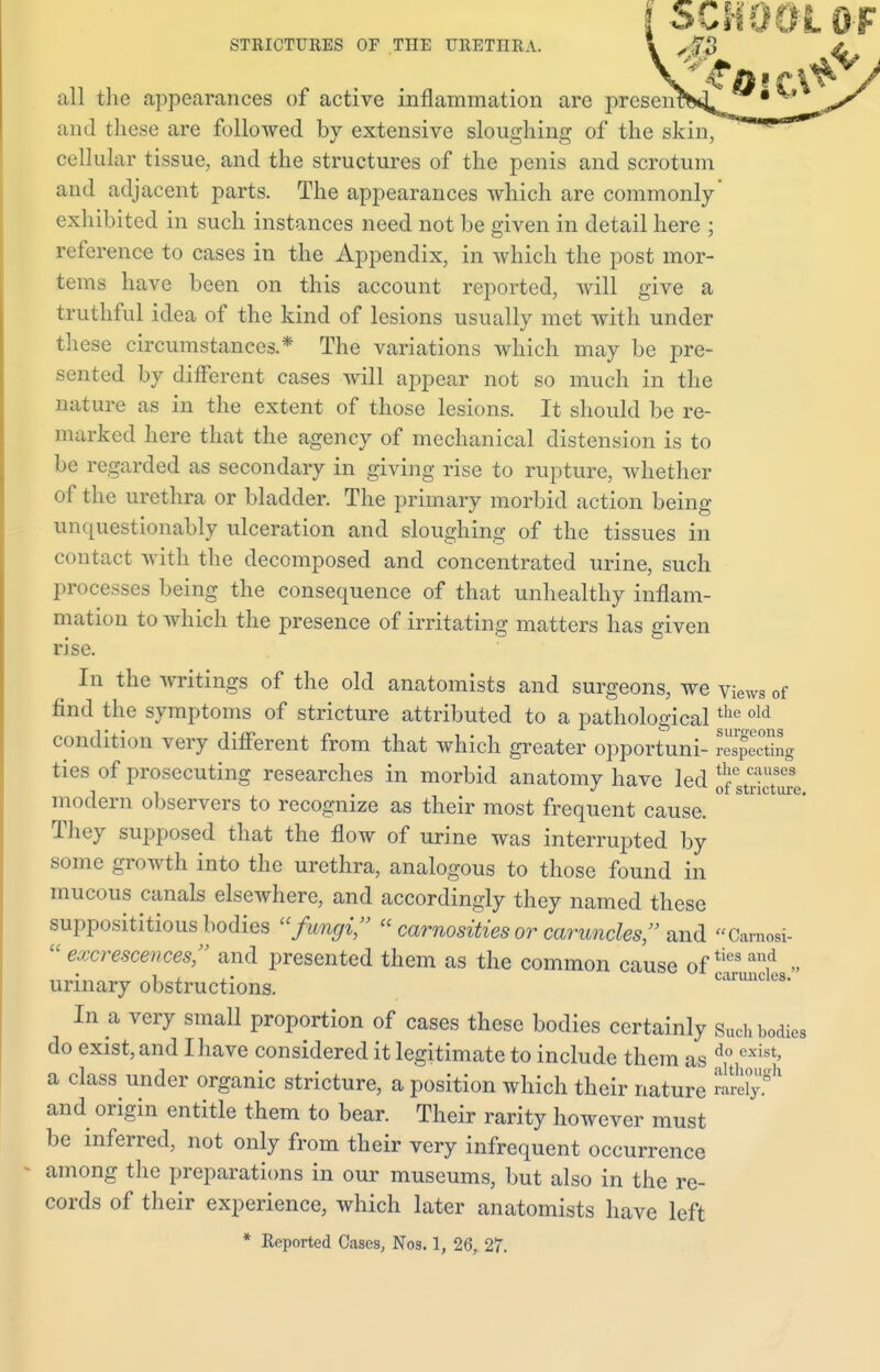 x ^?ll!fA^ all the appearances of active inflammation are presenta4^_* ^' and these are followed by extensive sloughing of the skh\~~'rr~*0^ cellular tissue, and the structures of the penis and scrotum and adjacent parts. The appearances which are commonly' exhibited in such instances need not be given in detail here ; reference to cases in the Appendix, in which the post mor- tems have been on this account reported, will give a truthful idea of the kind of lesions usually met with under these circumstances.* The variations which may be pre- sented by different cases will appear not so much in the nature as in the extent of those lesions. It should be re- marked here that the agency of mechanical distension is to be regarded as secondary in giving rise to rupture, whether of the urethra or bladder. The primary morbid action being unquestionably ulceration and sloughing of the tissues in contact with the decomposed and concentrated urine, such processes being the consequence of that unhealthy inflam- mation to which the presence of irritating matters has given rise. In the writings of the old anatomists and surgeons, we views of find the symptoms of stricture attributed to a pathologicalthe old condition very different from that which greater opportuni- reacting ties of prosecuting researches in morbid anatomy have led StSJe modern observers to recognize as their most frequent cause. They supposed that the flow of urine was interrupted by some growth into the urethra, analogous to those found in mucous canals elsewhere, and accordingly they named these supposititious bodies fumyi?  carnosities or caruncles;' and Carnosi- u excrescences, and presented them as the common cause ofties an,d » urinary obstructions. caruncle* In a very small proportion of cases these bodies certainly Such bodies do exist,and Ihave considered it legitimate to include them as do exist' a class under organic stricture, a position which their nature and origin entitle them to bear. Their rarity however must be inferred, not only from their very infrequent occurrence among the preparations in our museums, but also in the re- cords of their experience, which later anatomists have left * Reported Cases, Nos. 1, 26, 27.