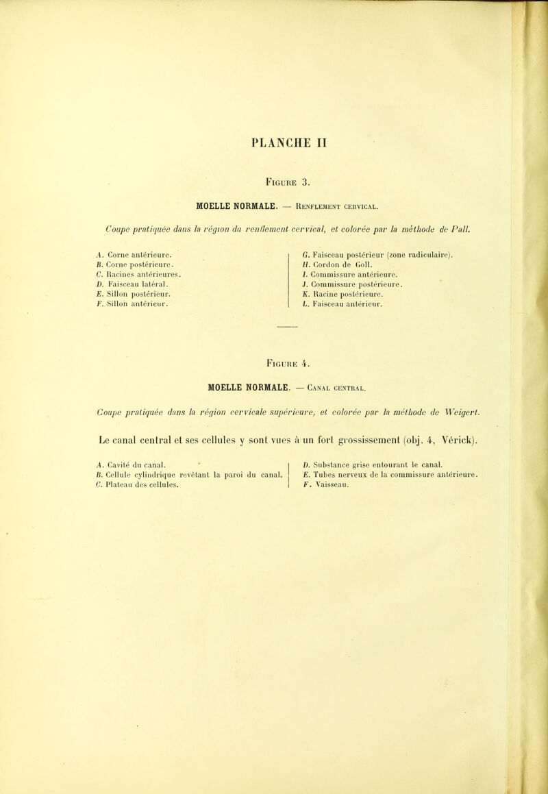 Figure 3. MOELLE NORMALE. — Renflement cervical. Coupe pratiquée dans la région du ronllement cervical, et colorée par la méthode de Pall. A. Corne antérieure. B. Corne postérieure. C. Racines antérieures. D. Faisceau latéral. E. Sillon postérieur. F. Sillon antérieur. G. Faisceau postérieur (zone radiculaire). H. Gordon de Coll. J. Commissure antérieure. J. Commissure postérieure. K. Racine postérieure. L. Faisceau antérieur. Figure 4. MOELLE NORMALE. — Canal central. Coupe pratiquée dans la région cervicale supérieure, et colorée par la méthode de Weigert. Le canal central et ses cellules y sont vues à un fort grossissement (obj. 4, Vérick). A. Cavité du canal. B. Cellule cylindi'ique revêtant la paroi du canal. C. Plateau des cellules. D. Substance grise entourant le canal. E. Tubes nerveux de la commissure antérieure. F. Vaisseau.