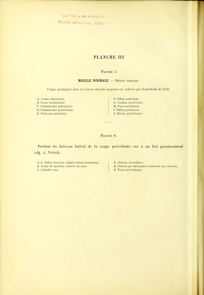 PiÛiCO-GWFUHGlCAL SOCii: i r PLANCHE m Figure 5. MOELLE NORMALE. — Région dorsale. Coupe pratiquée dans la région dorsale moyenne et colorée par la méthode de Pall. A. Corne antérieure. B. Corne postérieure. C. Commissure antérieure. D. Commissure postérieure. E. Faisceau antérieur. F. Sillon antérieur. G. Cordon postérieur. U. Faisceau latéral. I. Sillon postérieur. J. Racine postérieure. Figure 6. Portion du faisceau latéral de la coupe précédente, vue à un fort grossissement (obj. 4, Vérick). A-A. Tubes nerveux coupés transversalement. B. Gaine de myéline colorée en noir. C. Cylindre axe. D. E. F. Cloison secondaire. Cloison pie-mérienne Tissu névroglique. contenant un vaisseau.