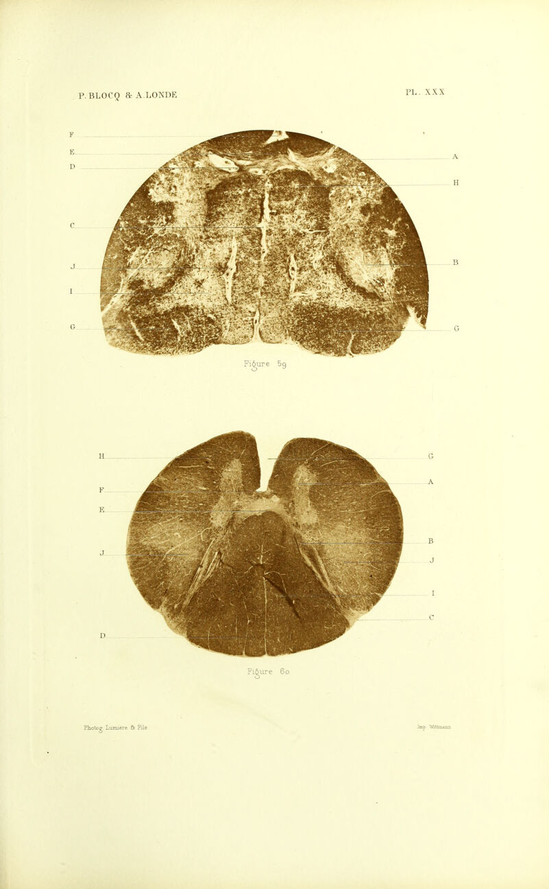 p. BLOCQ 8c A.LONDE B G Fiôure 60 Liuniére & PiIs Jmp Wittmajm