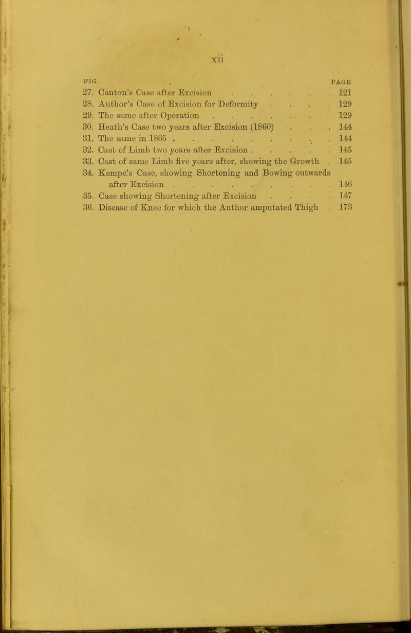 Xll 1 FIG. . PAGE 27. Canton's Case after Excision 121 28. Author's Case of Excision for Deformity .... 129 29. The same after Operation 129 30. Heath's Case two yeai's after Excision (1860) . . 144 31. The same in 1865 . .144 32. Oast of Limb two years after Excision 145 33. Oast of same Limb five years after, showing the Growth . 145 34. Kempe.'s Oase, showing Shortening and Bowing outwards after Excision ......... 14G 35. Oase showing Shortening after Excision .... 147 36. Disease of Elnee for which the Author amputated Thigh 173