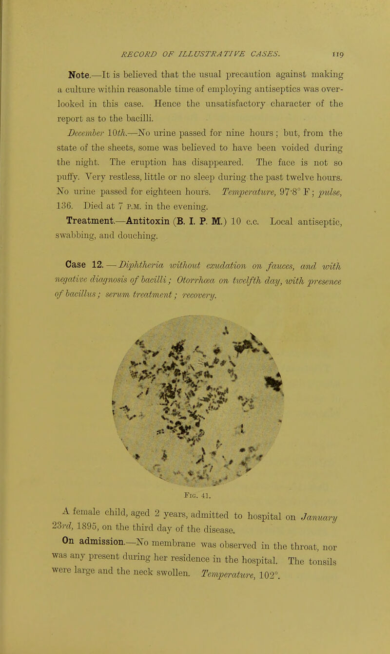 Note.—It is believed that the usual precaution against making a culture witliin reasonable time of employing antiseptics was over- looked in this case. Hence the unsatisfactory character of the report as to the bacilli. December lO^/i.—No urine passed for nine hours ; but, from the state of the sheets, some was believed to have been voided during the night. The eruption has disappeared. The face is not so puffy. Very restless, little or no sleep during the past twelve hours. No urine passed for eighteen hours. Temperature, 97'8° F; pulse, 136. Died at 7 p.m. in the evening. Treatment—Antitoxin (B. I. P. M.) 10 c.c. Local antiseptic, swabbing, and douching. Case 12. — Diphtheria withmot exudation on fauces, and with negative diagnosis of bacilli ; Otorrhcea on twelfth day, with presence of bacillus; serum treatment; recovery. >'*^ ij'*',^ > '^' ^^M .... ^ Fig. 41. A female child, aged 2 years, admitted to hospital on January 2Zrd, 1895, on the third day of the disease. On admission.—No membrane was observed in the throat, nor was any present during her residence in the hospital. The tonsils were large and the neck swollen. Temperature, 102°.