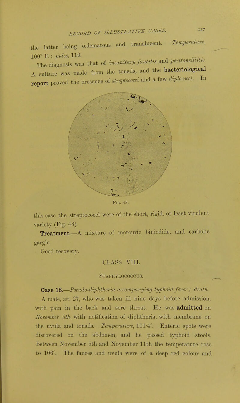 the latter being CBclematous and translucent. T.n^cratur., 100^ F.; Fi^sc, 110. The diagnosis was that of i^x^an^cmj fcmtiX^ ^-^^ Witon^^lhUs. A culture was made from the tonsils, and the bacteriological report proved the presence of streptococci and a few di^lococci. In Oft— Fig. 48. this case the streptococci were of the short, rigid, or least virulent variety (Fig. 48). Treatment.—A mixture of mercuric hiniodide, and carbolic gargle. Good recovery. CLASS VIII. Staphylococcus. Case 18.—Fsmdo-dvplitluria accovipanying typhoid fever; death. A male, eet. 27, who was taken ill nine days before admission, with pain in the back and sore throat. He was admitted on Movember 5th with notification of diphtheria, with membrane on the uvula and tonsils. Temperature, 101-4°. Enteric spots were discovered on the abdomen, and he passed typhoid stools. Between November 5th and November 11th the temperature rose to 106°. The fauces and uvula were of a deep red colour and