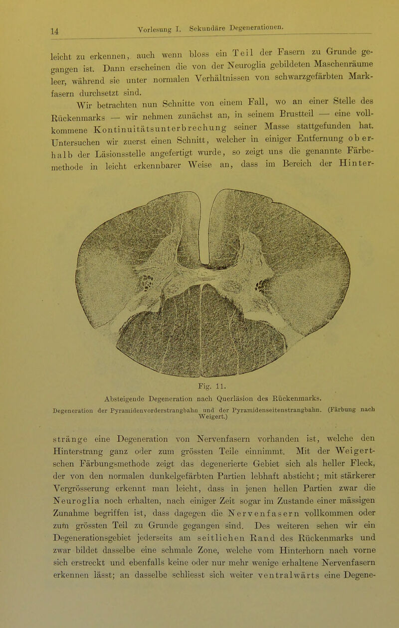 leicht zu erkennen, auch wenn bloss ein Teil der Fasern zu Grunde ge- gangen ist. Dann erscheinen die von der Neuroglia gebildeten Maschenräume leer, während sie unter normalen Verhältnissen von schwarzgefärbten Mark- fasern durchsetzt sind. Wir betrachten nun Schnitte von einem FaU, wo an einer Stelle des Rückenmai-ks — wir nehmen zunächst an, in seinem Bmstteil — eine voU- kommene Kontinuitätsunterbrechung seiner Masse stattgefunden hat. Untersuchen wir zuerst einen Schnitt, welcher in einiger Entfernung ober- halb der Läsionsstelle angefertigt Avurde, so zeigt uns die genannte Färbe- methode in leicht erkennbarer Weise an, dass im Bereich der Hinter- Absteigeude Degeneration nach Querläsion des Rückenmarks. Degeneration der Pyi-amütenvorderstrangbahn und der Pyramidenseitenstrangbahn. (Färbvmg nach Weigert.) stränge eine Degeneration von Nervenfasern vorhanden ist, welche den Hinterstrang ganz oder zum grössten Teile einnimmt. Mit der Weigert- schen Färbungömethode zeigt das degenerierte Gebiet sich als heller Fleck, der von den normalen dunkelgefärbten Partien lebhaft absticht; mit stärkerer Vergrösserung erkennt man leicht, dass in jenen hellen Partien zwar die Neuroglia noch erhalten, nach einiger Zeit sogar im Zustande einer massigen Zunahme begriffen ist, dass dagegen die Nervenfasern vollkommen oder zutn grössten Teil zu Grunde gegangen sind. Des weiteren sehen wir ein Degenerationsgebiet jederseits am seitlichen Rand des Rückenmarks und zwar bildet dasselbe eine schmale Zone, welche vom Hinterhorn nach vorne sich erstreckt und ebenfalls keine oder nur mehr wenige erhaltene Nervenfasern erkennen lässt; an dasselbe schliesst sich weiter ventralwärts eine Degene-