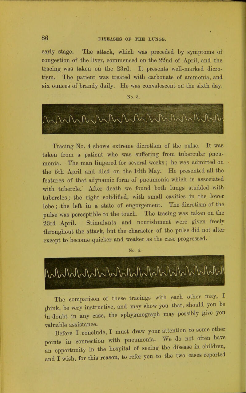 early stage. The attack, which was preceded by symptoms of congestion of the liver, commenced on the 22nd of April, and the tracing was taken on the 23rd. It presents well-marked dicro- tism. The patient was treated with carbonate of ammonia, and six ounces of brandy daily. He was convalescent on the sixth day. No. 3. Tracing No. 4 shows extreme dicrotism of the pulse. It was taken from a patient who was suffering from tubercular pneu- monia. The man lingered for several weeks ; he was admitted on the 5th April and died on the 16th May. He presented all the features of that adynamic form of pneumonia which is associated with tubercle.' After death we found both lungs studded with tubercles; the right solidified, with small cavities in the lower lobe; the left in a state of engorgement. The dicrotism of the pulse was perceptible to the touch. The tracing was taken on the 23rd April. Stimulants and nourishment were given freely throughout the attack, but the character of the pulse did not alter except to become quicker and weaker as the case progressed. No. 4. The comparison of these tracings with each other may, I think, be very instructive, and may show you that, should you be in doubt in any case, the sphygmogi-aph may possibly give you valuable assistance. Before I conclude, I must draw your attention to some other points in connection with pneumonia. We do not often have an opportunity in the hospital of seeing the disease m children, and I wish, for this reason, to refer you to the two cases reported