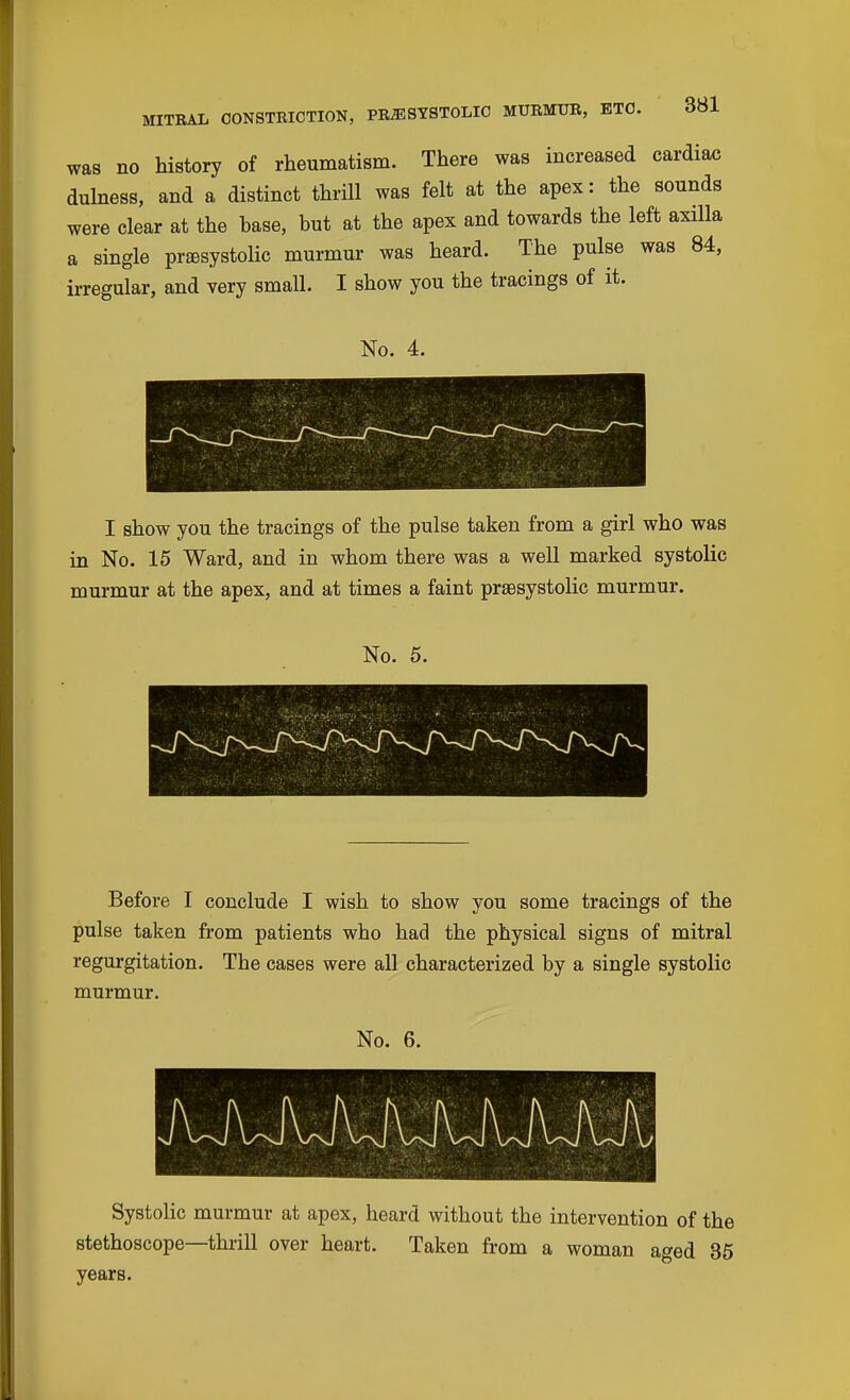 was no history of rheumatism. There was increased cardiac dulness, and a distinct thrill was felt at the apex: the sounds were clear at the base, but at the apex and towards the left axilla a single presystolic murmur was heard. The pulse was 84, irregular, and very small. I show you the tracings of it. No. 4. I show you the tracings of the pulse taken from a girl who was in No. 15 Ward, and in whom there was a well marked systolic murmur at the apex, and at times a faint prsBsystolic murmur. No. 5. Before I conclude I wish to show you some tracings of the pulse taken from patients who had the physical signs of mitral regurgitation. The cases were all characterized by a single systolic murmur. No. 6. Systolic murmur at apex, heard without the intervention of the stethoscope—thrill over heart. Taken from a woman aged 35 years.