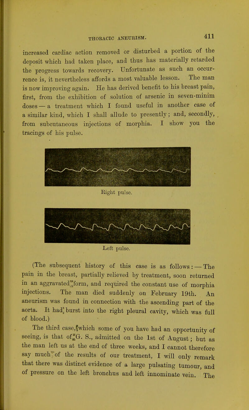 increased cardiac action removed or disturbed a portion of the deposit which had taken place, and thus has materially retarded the progress towards recovery. Unfortunate as such an occur- rence is, it nevertheless affords a most valuable lesson. The man is now improving again. He has derived benefit to his breast pain, first, from the exhibition of solution of arsenic in seven-minim doses — a treatment which I found useful in another case of a similar kind, which I shall allude to presently; and, secondly, from subcutaneous injections of morphia. I show you the tracings of his pulse. Eight pulse. Left pulse. (The subsequent history of this case is as follows: — The pain in the breast, partially relieved by treatment, soon returned in an aggravated^form, and required the constant use of morphia injections. The man died suddenly on February 19th. An aneurism was found in connection with the ascending part of the aorta. It had' burst into the right pleural cavity, which was full of blood.) The third case,?which some of you have had an opportunity of seeing, is that of^G. S,, admitted on the 1st of August; but as the man left us at the end of three weeks, and I cannot therefore say much^'of the results of our treatment, I will only remark that there was distinct evidence of a large pulsating tumour, and of pressure on the left bronchus and left innominate vein. The