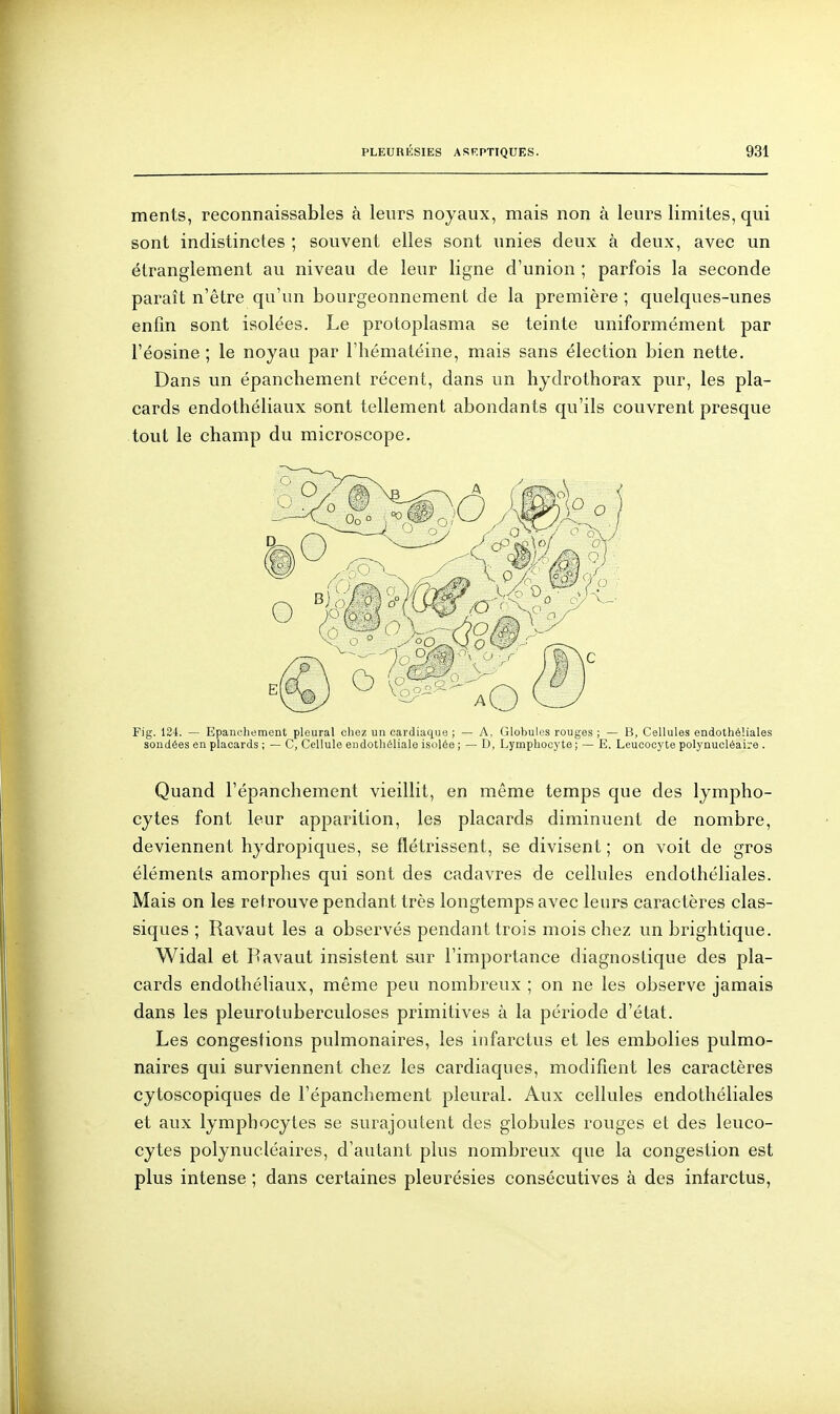 ments, reconnaissables à leurs noyaux, mais non à leurs limites, qui sont indistinctes ; souvent elles sont unies deux à deux, avec un étranglement au niveau de leur ligne d'union ; parfois la seconde paraît n'être qu'un bourgeonnement de la première ; quelques-unes enfin sont isolées. Le protoplasma se teinte uniformément par l'éosine ; le noyau par l'hématéine, mais sans élection bien nette. Dans un épanchement récent, dans un hydrothorax pur, les pla- cards endothéliaux sont tellement abondants qu'ils couvrent presque tout le champ du microscope. Fig. 124. — Epanchement pleural chez un cardiaque ; — A, Globules rouges ; — B, Cellules endothéliales sondées en placards ; — C, Cellule eiidothéliale isolée ; — D, Lymphocyte ; — E, Leucocyte polynucléaire . Quand l'épanchement vieillit, en même temps que des lympho- cytes font leur apparition, les placards diminuent de nombre, deviennent hydropiques, se flétrissent, se divisent ; on voit de gros éléments amorphes qui sont des cadavres de cellules endothéliales. Mais on les retrouve pendant très longtemps avec leurs caractères clas- siques ; Ravaut les a observés pendant trois mois chez un brightique. Widal et Pavaut insistent sur l'importance diagnostique des pla- cards endothéliaux, même peu nombreux ; on ne les observe jamais dans les pleurotuberculoses primitives à la période d'état. Les congestions pulmonaires, les infarctus et les embolies pulmo- naires qui surviennent chez les cardiaques, modifient les caractères çytoscopiques de l'épanchement pleural. Aux cellules endothéliales et aux lymphocytes se surajoutent des globules rouges et des leuco- cytes polynucléaires, d'autant plus nombreux que la congestion est plus intense ; dans certaines pleurésies consécutives à des infarctus,