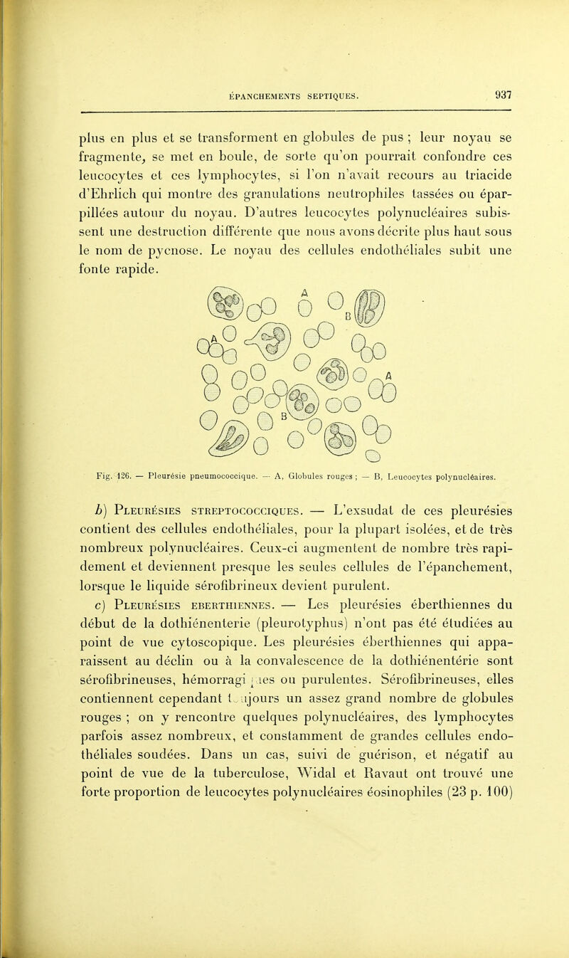 plus en plus et se transforment en globules de pus ; leur noyau se fragmente, se met en boule, de sorte qu'on pourrait confondre ces leucocytes et ces lymphocytes, si l'on n'avait recours au triacide d'Ehrlich qui montre des granulations neutrophiles tassées ou épar- pillées autour du noyau. D'autres leucocytes polynucléaires subis- sent une destruction différente que nous avons décrite plus haut sous le nom de pycnose. Le noyau des cellules endothéliales subit une fonte rapide. Fig. 126. — Pleurésie pneumoooooique. — A, Globules rouges ; — B, Leucocytes polynucléaires. b) Pleurésies streptococciques. — L'exsudat de ces pleurésies contient des cellules endothéliales, pour la plupart isolées, et de très nombreux polynucléaires. Ceux-ci augmentent de nombre très rapi- dement et deviennent presque les seules cellules de l'épanchement, lorsque le liquide sérofibrineux devient purulent. c) Pleurésies eberthiennes. — Les pleurésies éberthiennes du début de la dothiénenterie (pleurotyphus) n'ont pas été étudiées au point de vue cytoscopique. Les pleurésies éberthiennes qui appa- raissent au déclin ou à la convalescence de la dothiénentérie sont sérofibrineuses, hémorragi ; les ou purulentes. Sérofîbrineuses, elles contiennent cependant t ajours un assez grand nombre de globules rouges ; on y rencontre quelques polynucléaires, des lymphocytes parfois assez nombreux, et constamment de grandes cellules endo- théliales soudées. Dans un cas, suivi de guérison, et négatif au point de vue de la tuberculose, Widal et Ravaut ont trouvé une forte proportion de leucocytes polynucléaires éosinophiles (23 p. 100)