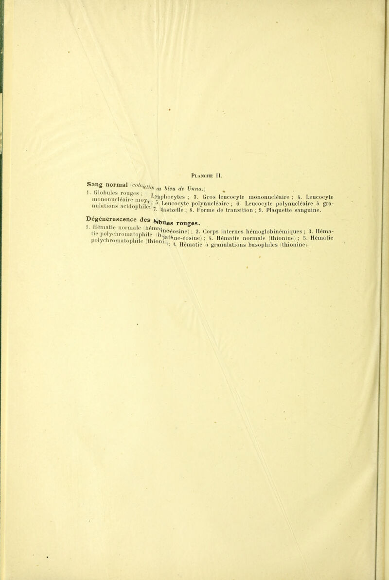 Sang normal (crt/o,w,- ,, , , ^, , Oi fu bleu de. Unna.} 1. Globules rouées ; i mononucléaire moy,^^^!''^*^^''' nulations acidophilei'^ 3. Gros leucocyte mononucléaire ; 4. Leucocyte Leucocyte polynucléaire ; 6. Leucocyte polynucléaire à gra- 4astzelle ; 8. Forme de transition ; 9. Plaquette sanguine. Dégénérescence des fe^^u^s rouges. 1. Hématie normale ihérn,\-^, . f . , ., o u- tie polychromatophile «osine) ; 2. Corps miernes hemoglobmemiques ; 3. Hema- polychromatophile (thion^^^*^*'^°^'*^^ ' ^^^matie normale (thionine) ; 5. Hématie ■); Hématie à granulations basophiles (thionine).