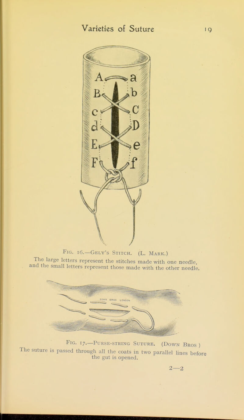 Fig. i6.—Gely's Stitch. (L. Mark.) The large letters represent the stitches made with one needle, and the small letters represent those made with the other needle. Fig. 17.—Purse-string Suture. (Down Bros ) suture is passed through all the coats in two parallel Unes before the gut is opened. 2—2