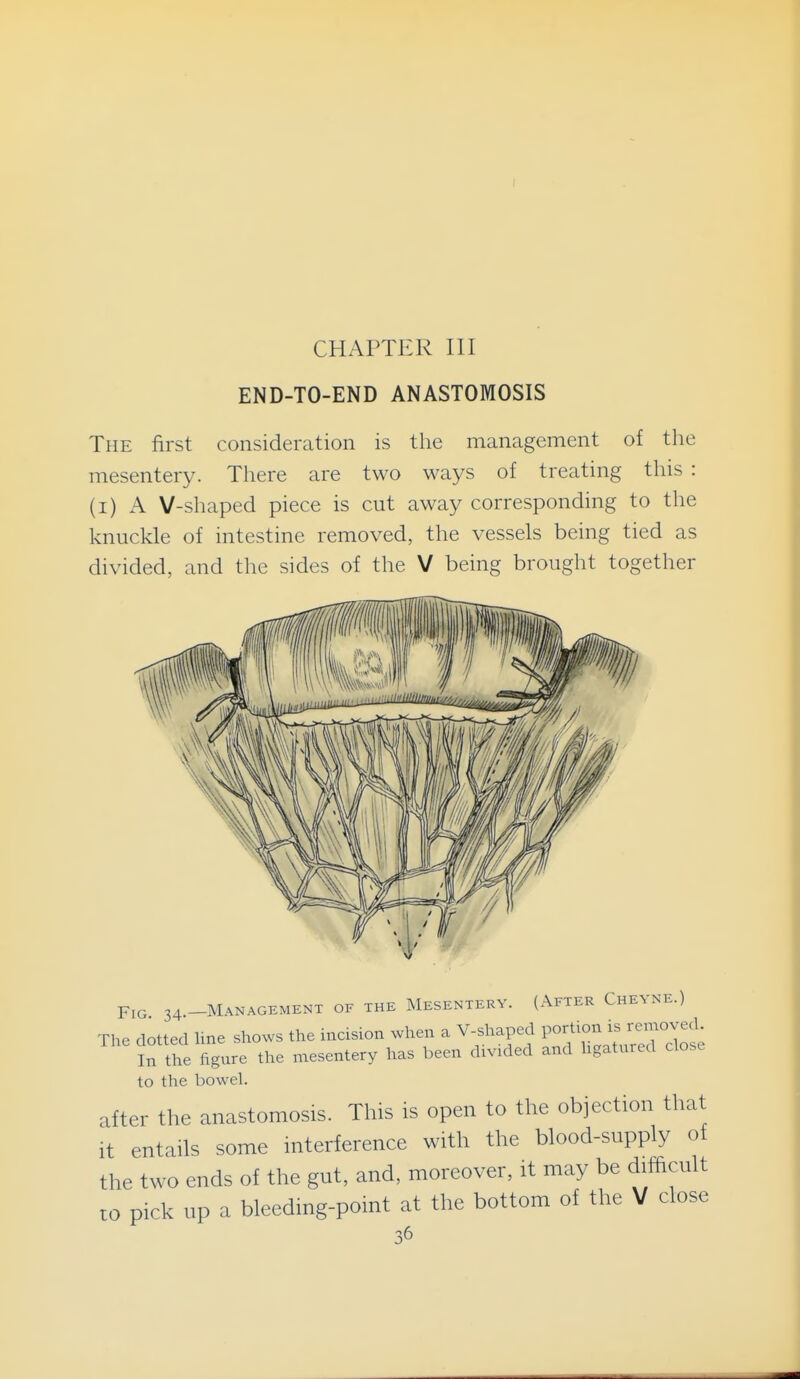 CHAPTER III END-TO-END ANASTOMOSIS The first consideration is the management of the mesentery. There are two ways of treating this : {i) A V-shaped piece is cut away corresponding to the knuckle of intestine removed, the vessels being tied as divided, and the sides of the V being brought together 34 -Management of the Mesentery. (After Cheyne.) The dotted ime shows the incision when a V-shaped l-^^^^^^-^^;^;^; In the figure the mesentery has been divided and hgatured close to the bowel. after the anastomosis. This is open to the objection that it entails some interference with the blood-supply of the two ends of the gut, and, moreover, it may be difficult to pick up a bleedmg-point at the bottom of the V close