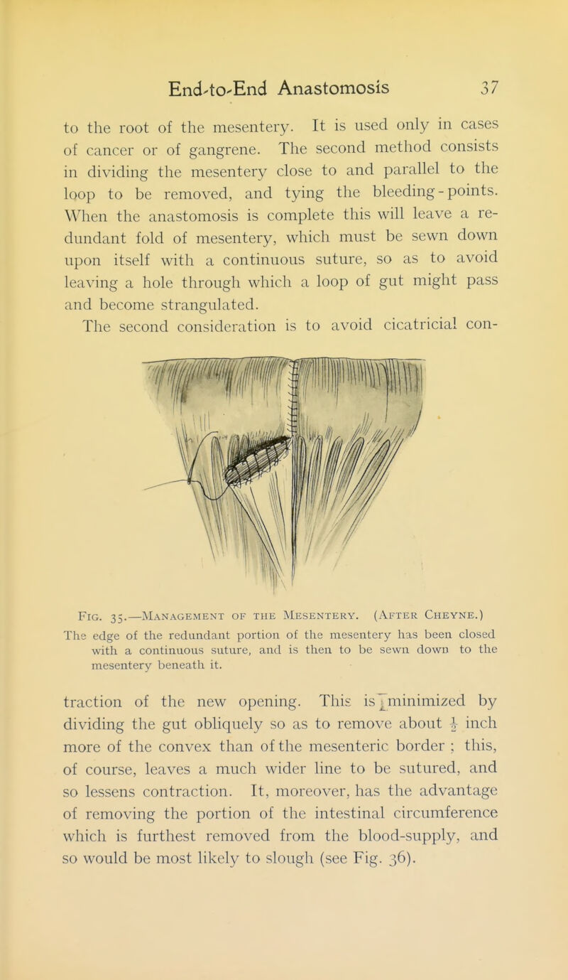 to the root of the mesentery. It is used only in cases of cancer or of gangrene. The second method consists in dividing the mesentery close to and parallel to the loop to be removed, and tying the bleeding - points. When the anastomosis is complete this will leave a re- dundant fold of mesentery, which must be sewn down upon itself with a continuous suture, so as to avoid leaving a hole through which a loop of gut might pass and become strangulated. The second consideration is to avoid cicatricial con- FiG. 35.—Management of the Mesentery. (After Cheyne.) The edge of the redundant portion of the mesentery has been closed with a continuous suture, and is then to be sewn down to the mesentery beneath it. traction of the new opening. This isYminimized by dividing the gut obliquely so as to remove about ^ inch more of the convex than of the mesenteric border ; this, of course, leaves a much wider line to be sutured, and so lessens contraction. It, moreover, has the advantage of removing the portion of the intestinal circumference which is furthest removed from the blood-supply, and so would be most likely to slough (see Fig. 36).