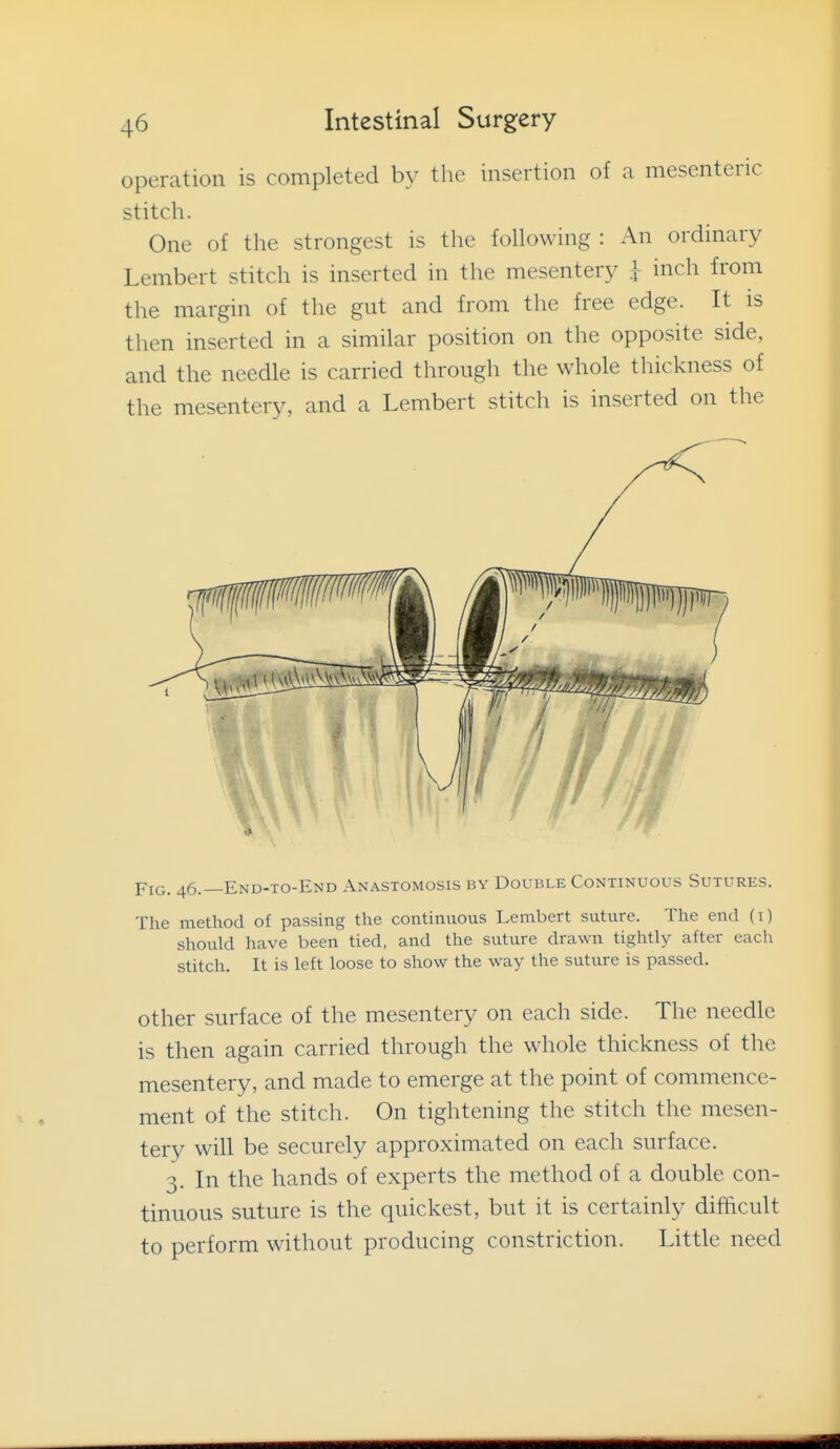 operation is completed by the insertion of a mesenteric stitch. One of the strongest is the following : An ordinary Lembert stitch is inserted in the mesentery ^ inch from the margin of the gut and from the free edge. It is then inserted in a similar position on the opposite side, and the needle is carried through the whole thickness of the mesentery, and a Lembert stitch is inserted on the Fig. 46.—End-to-End Anastomosis by Double Continuous Sutures. The method of passing the continuous Lembert suture. The end (i) should have been tied, and the suture drawn tightly after each stitch. It is left loose to show the way the suture is passed. other surface of the mesentery on each side. The needle is then again carried through the whole thickness of the mesentery, and made to emerge at the point of commence- ment of the stitch. On tightening the stitch the mesen- tery will be securely approximated on each surface. 3. In the hands of experts the method of a double con- tinuous suture is the quickest, but it is certainly difficult to perform without producing constriction. Little need