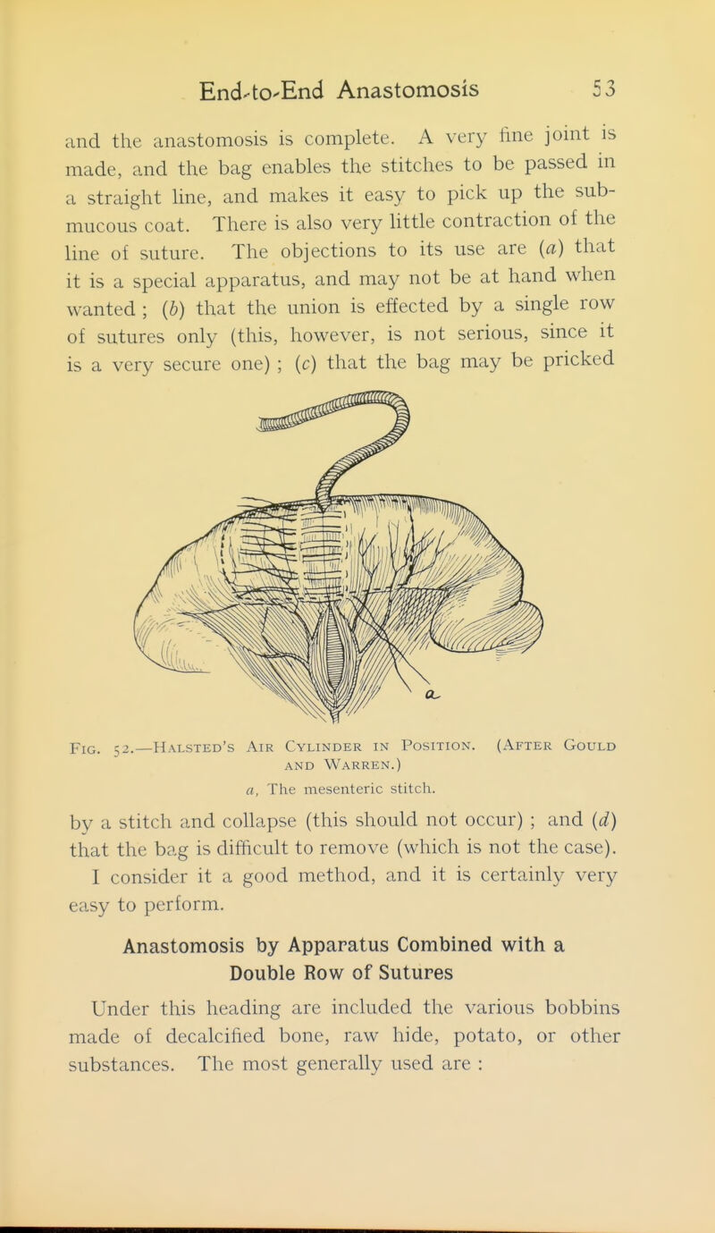 and the anastomosis is complete. A very fine joint is made, and the bag enables the stitches to be passed in a straight line, and makes it easy to pick up the sub- mucous coat. There is also very httle contraction of the line of suture. The objections to its use are {a) that it is a special apparatus, and may not be at hand when wanted ; (b) that the union is effected by a single row of sutures only (this, however, is not serious, since it is a very secure one) ; (c) that the bag may be pricked Piti_ -2.—Halsted's Air Cylinder in Position. (After Gould AND Warren.) a, The mesenteric stitch. by a stitch and collapse (this should not occur) ; and {d) that the bag is difficult to remove (which is not the case). I consider it a good method, and it is certainly very easy to perform. Anastomosis by Apparatus Combined with a Double Row of Sutures Under this heading are included the various bobbins made of decalcified bone, raw hide, potato, or other substances. The most generally used are :