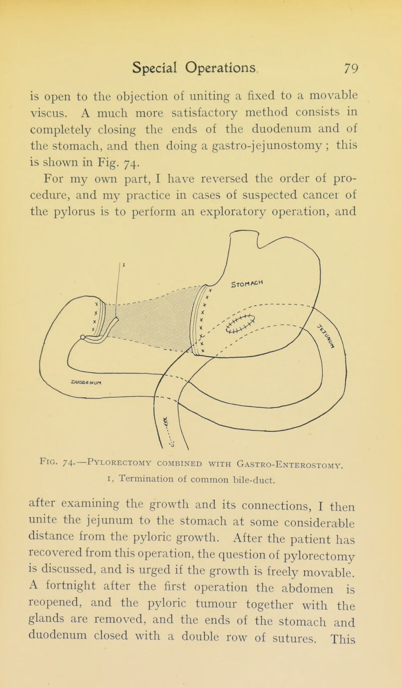 is open to the objection of uniting a fixed to a movable viscus. A much more satisfactory method consists in completely closing the ends of the duodenum and of the stomach, and then doing a gastro-jejunostomy ; this is shown in Fig. 74. For my own part, I have reversed the order of pro- cedure, and my practice in cases of suspected cancer of the pylorus is to perform an exploratory operation, and Fig. 74.—Pylorectomy combined with Gastro-Enterostomy. I, Termination of common bile-duct. after examining the growth and its connections, I then unite the jejunum to the stomach at some considerable distance from the pyloric growth. After the patient has recovered from this operation, the question of pylorectomy is discussed, and is urged if the growth is freely movable. A fortnight after the first operation the abdomen is reopened, and the pyloric tumour together with the glands are removed, and the ends of the stomach and duodenum closed with a double row of sutures. This