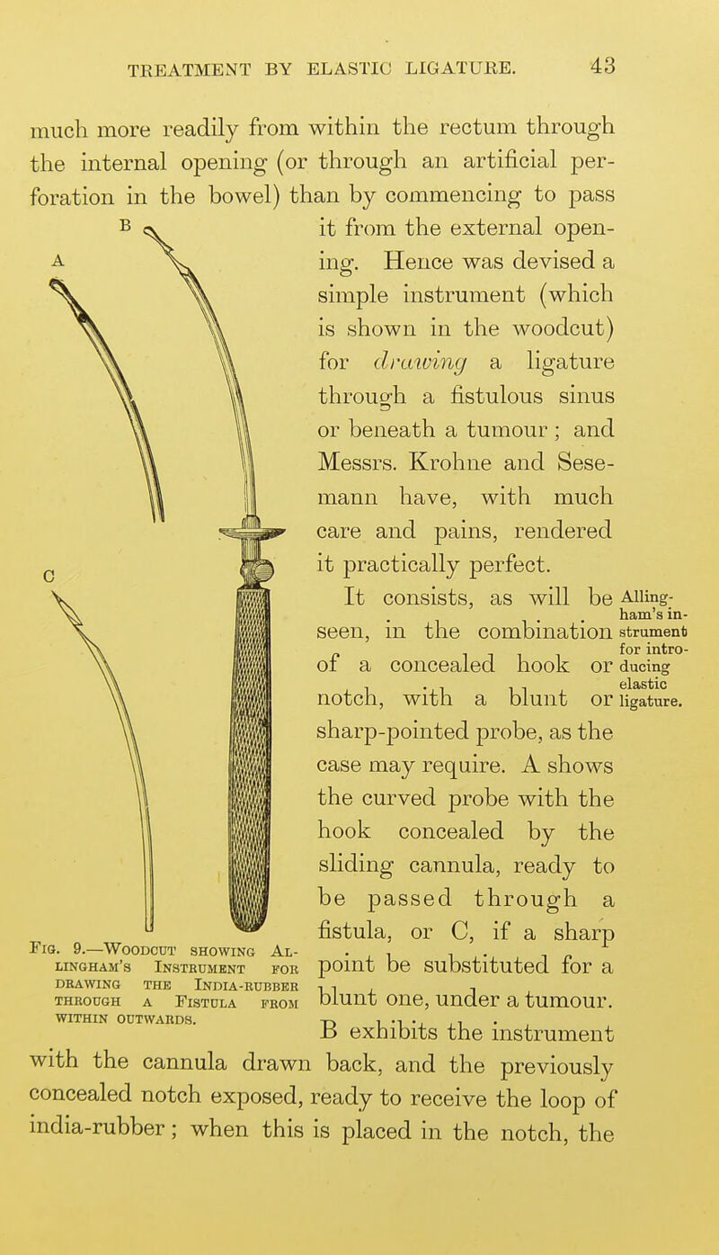 much more readily from within the rectum through the internal opening (or through an artificial per- foration in the bowel) than by commencing to pass it from the external open- ing. Hence was devised a simple instrument (which is shown in the woodcut) for drutving a ligature throug'h a fistulous sinus or beneath a tumour ; and Messrs. Krohne and Sese- mann have, with much care and pains, rendered it practically perfect. It consists, as will ill ■ mi be Alling- . ham's in- seen, m the combniation strument of a concealed hook or ducmg notch, with a blunt or ligature. sharp-pointed probe, as the case may require. A shows the curved probe with the hook concealed by the sliding cannula, ready to be passed through a fistula, or C, if a sharp point be substituted for a blunt one, under a tumour. B exhibits the instrument with the cannula drawn back, and the previously concealed notch exposed, ready to receive the loop of india-rubber; when this is placed in the notch, the FlQ. 9.—WOODCDT SHOWING Al- lingham's Instrument for DRAWING THE InDIA-RUBBER THROUGH A FlSTULA FROM WITHIN OUTWARDS.