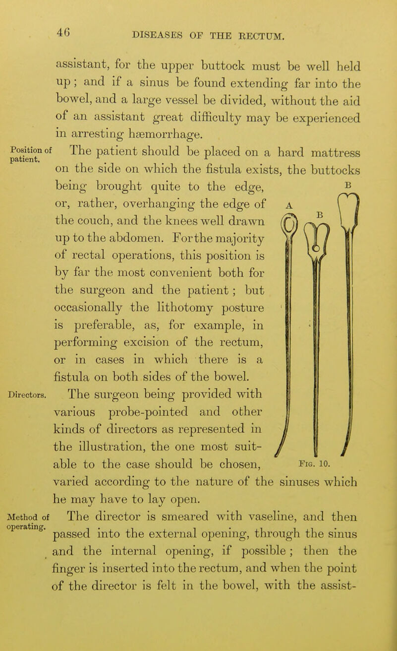 Position of patient. assistant, for the upper buttock must be well held up; and If a sinus be found extending far into the bowel, and a large vessel be divided, without the aid of an assistant great difficulty may be experienced in arresting haemorrhage. The patient should be placed on a hard mattress on the side on which the fistula exists, the buttocks being brought quite to the edge, or, rather, overhanging the edge of the couch, and the knees well drawn up to the abdomen. Forthe majority of rectal operations, this position is by far the most convenient both for the surgeon and the patient; but occasionally the lithotomy posture is preferable, as, for example, in performing excision of the rectum, or in cases in which there is a fistula on both sides of the bowel. Directors. The surgeou being provided with various probe-pointed and other kinds of directors as represented in the illustration, the one most suit- able to the case should be chosen, Fig. lo. varied according to the nature of the sinuses which he may have to lay open. The director is smeared with vaseline, and then passed into the external opening, through the sinus and the internal opening, if possible; then the finger is inserted into the rectum, and when the point of the director is felt in the bowel, with the assist- Method of operating.