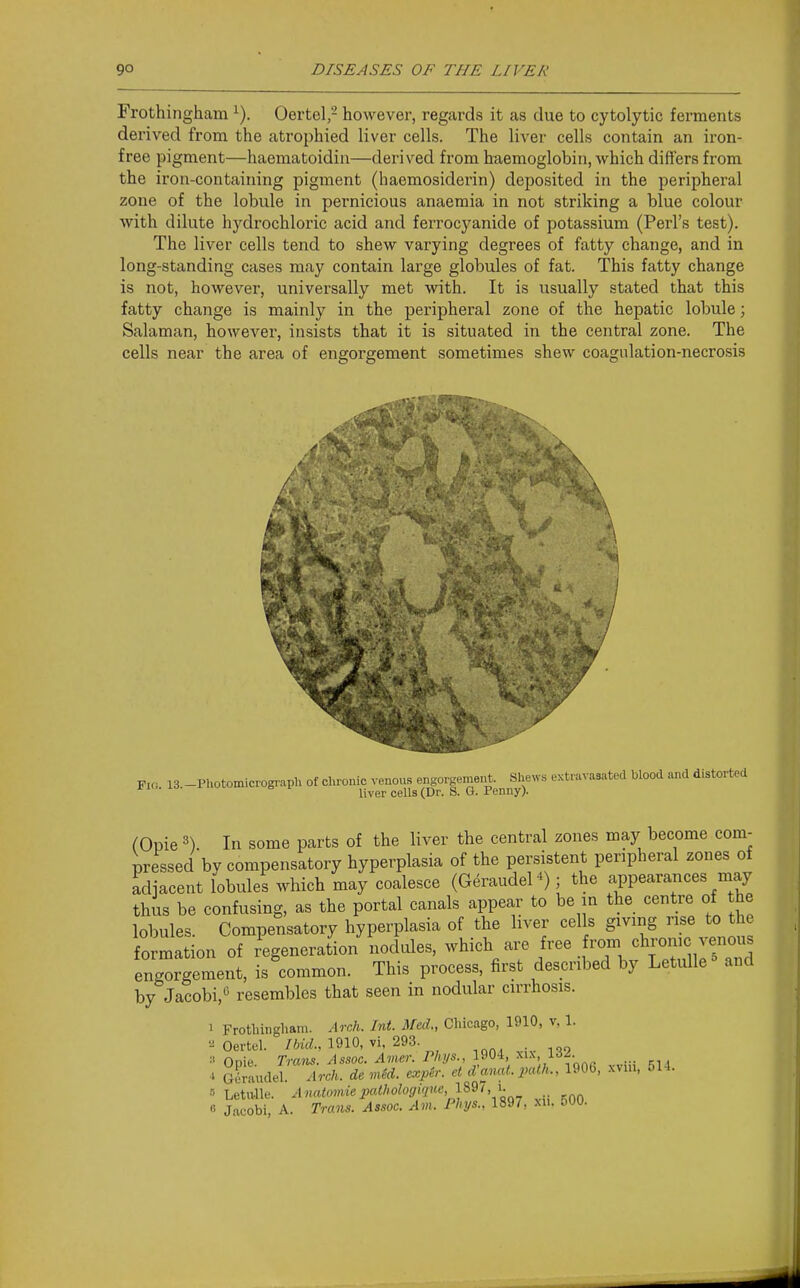 Frothingham ^). Oertel,- however, regards it as due to cytolytic ferments derived from the atrophied liver cells. The liver cells contain an iron- free pigment—haematoidin—derived from haemoglobin, which differs from the iron-containing pigment (haemosiderin) deposited in the peripheral zone of the lobule in pernicious anaemia in not striking a blue colour with dilute hydrochloric acid and ferrocyanide of potassium (Perl's test). The liver cells tend to shew varying degrees of fatty change, and in long-standing cases may contain large globules of fat. This fatty change is not, however, universally met with. It is usually stated that this fatty change is mainly in the peripheral zone of the hepatic lobule; Salaman, however, insists that it is situated in the central zone. The cells near the area of engorgement sometimes shew coagulation-necrosis V Fk, 13 -Photomicrograpli of clironic venous e.i.orge.neut. She^v•s extravasated blood and distorted liver cells (Dr. S. G. Penny). (Opie In some parts of the liver the central zones may become com- pressed by compensatory hyperplasia of the persistent peripheral zones of adjacent lobules which may coalesce (Geraudel ; the appearances may thus be confusing, as the portal canals appear to be in the centre of he lobules. Compensatory hyperplasia of the liver cells giving rise to the formation of regeneration nodules, which are free from chi'onic venous engorgement, is common. This process, first described by Letulle^ and by Jacobi,'^ resembles that seen in nodular cirrhosis. 1 Frotlungliam. Arch. Int. Med., Chicago, 1910, v, 1. '•^Oertel. 1910, vi, 293. ,onivivl^9 Opie. r^ww. /Issoc. ^mer. PAys., 1904 MX, 132. 4 GLiudel. Arch, de vM. cxpir. et d'anal, path., 1906, xvin, 514. r> LetuJle. Anatomie pathologique 1891 , i. « Jacobi, A. Trans. Assoc. Am. Phys., 1897, xu. 500.