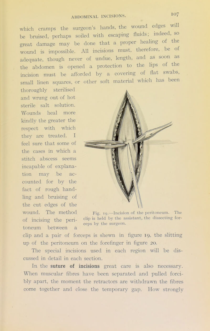 which cramps the surgeon's hands, the wound edges will be bruised, perhaps soiled with escaping fluids; indeed, so great damage may be done that a proper healing of the wound is impossible. All incisions must, therefore, be of adequate, though never of undue, length, and as soon as the abdomen is opened a protection to the lips of the incision must be afforded by a covering of flat swabs, small linen squares, or other soft material which has been thoroughly sterilised and wrung out of hot sterile salt solution. Wounds heal more kindly the greater the respect with which they are treated. I feel sure that some of the cases in which a stitch abscess seems incapable of explana- tion may be ac- counted for by the fact of rough hand- ling and bruising of the cut edges of the wound. The method of incising the peri- toneum between a clip and a pair of forceps is shewn in figure 19, the slitting up of the peritoneum on the forefinger in figure 20. The special incisions used in each region will be dis- cussed in detail in each section. In the suture of incisions great care is also necessary. When muscular fibres have been separated and pulled forci- bly apart, the moment the retractors are withdrawn the fibres come together and close the temporary gap. How strongly Fig. 19.—Incision of the peritoneum. The clip is held by the assistant, the dissecting for- ceps by the surgeon.