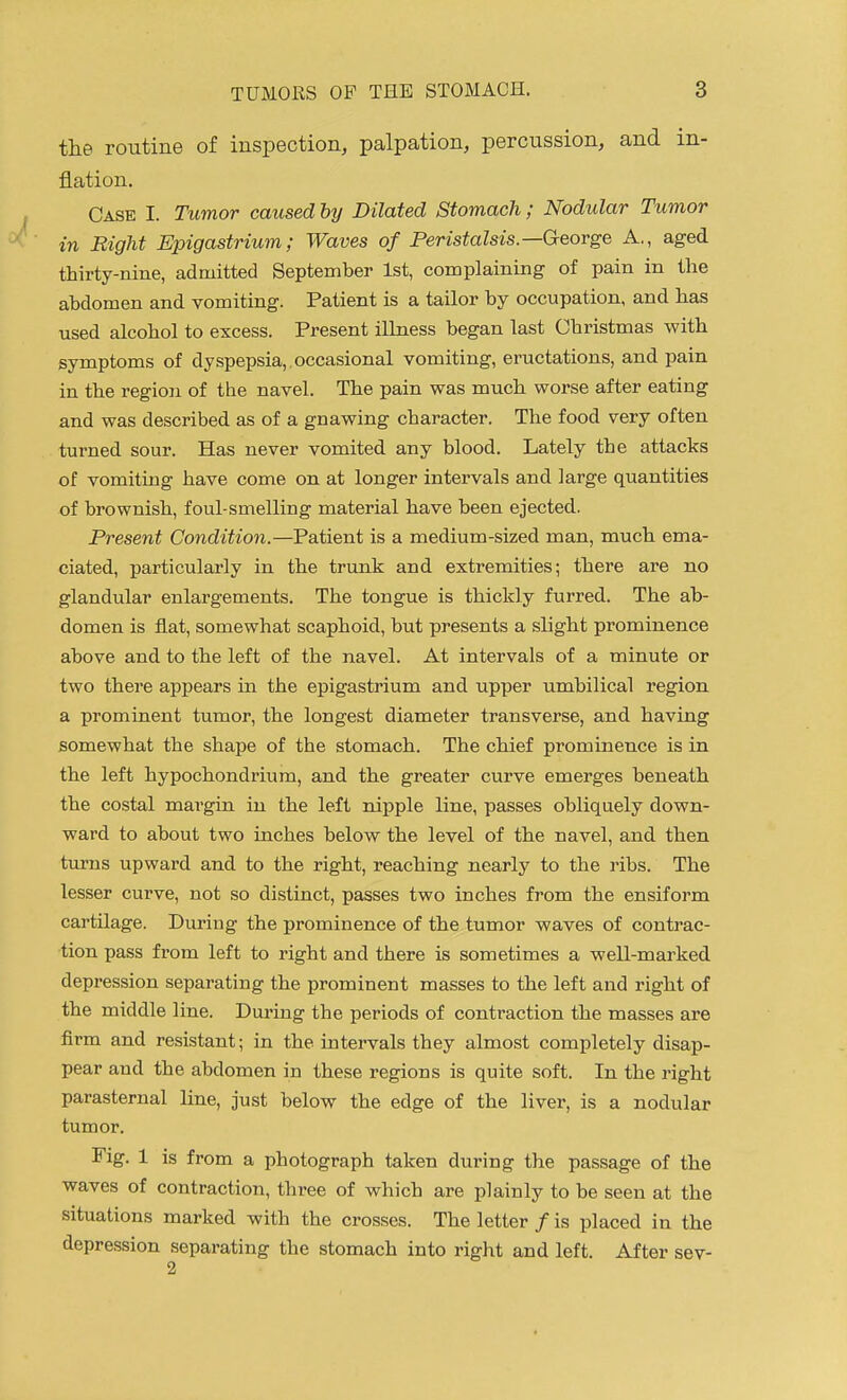 the routine of inspection, palpation, percussion, and in- flation. Case I. Tumor caused by Dilated Stomach ; Nodular Tumor in Right Epigastrium; Waves of Peristalsis.—George A,, aged thirty-nine, admitted September 1st, complaining of pain in the abdomen and vomiting. Patient is a tailor by occupation, and has used alcohol to excess. Present illness began last Christmas with symptoms of dyspepsia, , occasional vomiting, eructations, and pain in the region of the navel. The pain was much worse after eating and was described as of a gnawing character. The food very often turned sour. Has never vomited any blood. Lately the attacks of vomiting have come on at longer intervals and large quantities of brownish, foul-smelling material have been ejected. Present Condition.—Patient is a medium-sized man, much ema- ciated, particularly in the trunk and extremities; there are no glandular enlargements. The tongue is thickly furred. The ab- domen is flat, somewhat scaphoid, but presents a slight prominence above and to the left of the navel. At intervals of a minute or two there appears in the epigastrium and upper umbilical region a prominent tumor, the longest diameter transverse, and having somewhat the shape of the stomach. The chief prominence is in the left hypochondrium, and the greater curve emerges beneath the costal margin in the left nipple line, passes obliquely down- ward to about two inches below the level of the navel, and then turns upward and to the right, reaching nearly to the ribs. The lesser curve, not so distinct, passes two inches from the ensiform cartilage. During the prominence of the tumor waves of contrac- tion pass from left to right and there is sometimes a well-marked depression separating the prominent masses to the left and right of the middle line. During the periods of contraction the masses are firm and resistant; in the intervals they almost completely disap- pear and the abdomen in these regions is quite soft. In the right parasternal line, just below the edge of the liver, is a nodular tumor. Fig, 1 is from a photograph taken during the passage of the waves of contraction, three of which are plainly to be seen at the situations marked with the crosses. The letter / is placed in the depression separating the stomach into right and left. After sev-