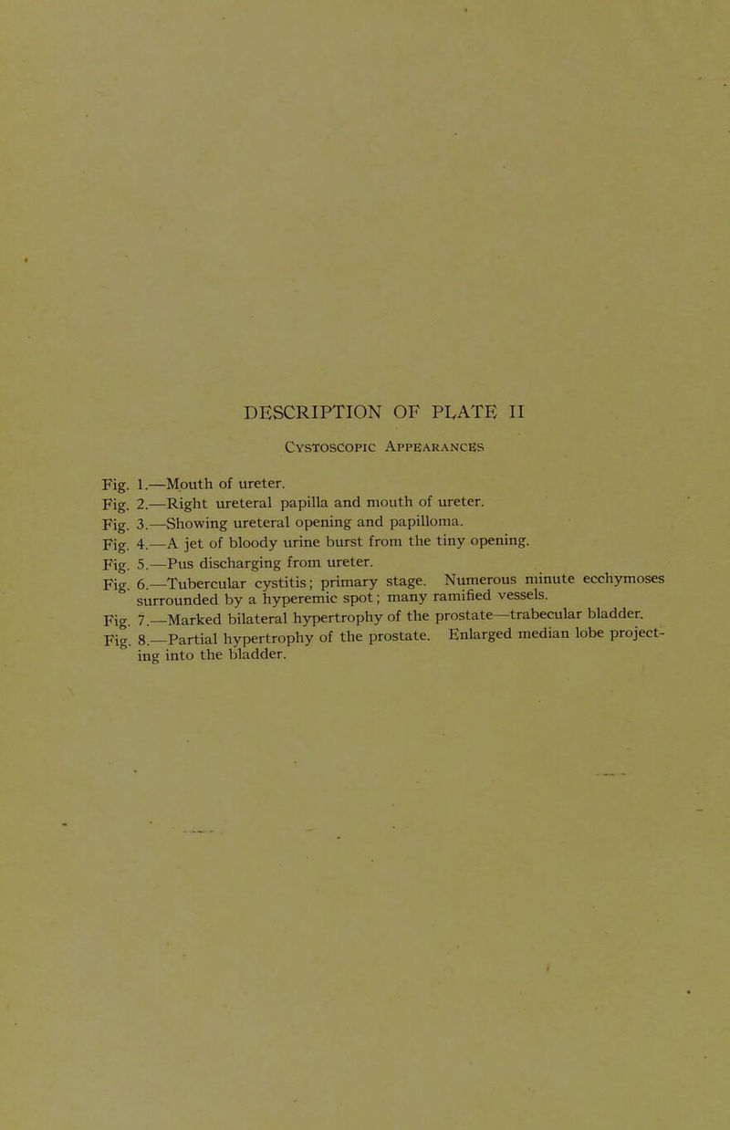 DESCRIPTION OF PLATE II CvsTosdoPic Appearances Fig. 1.—Mouth of ureter. Fig. 2.—Right ureteral papilla and mouth of ureter. Fig. 3.—Showing ureteral opening and papilloma. Fig. 4.—A jet of bloody urine burst from the tiny opening. Fig. 5.—Pus discharging from ureter. Fig 6.—Tubercular cystitis; primary stage. Numerous minute ecchymoses surrounded by a hyperemic spot; many ramified vessels. Fig. 7.—Marked bilateral hjrpertrophy of the prostate—trabecular bladder. Fig. 8.—Partial hypertrophy of the prostate. Enlarged median lobe project- ing into the bladder.