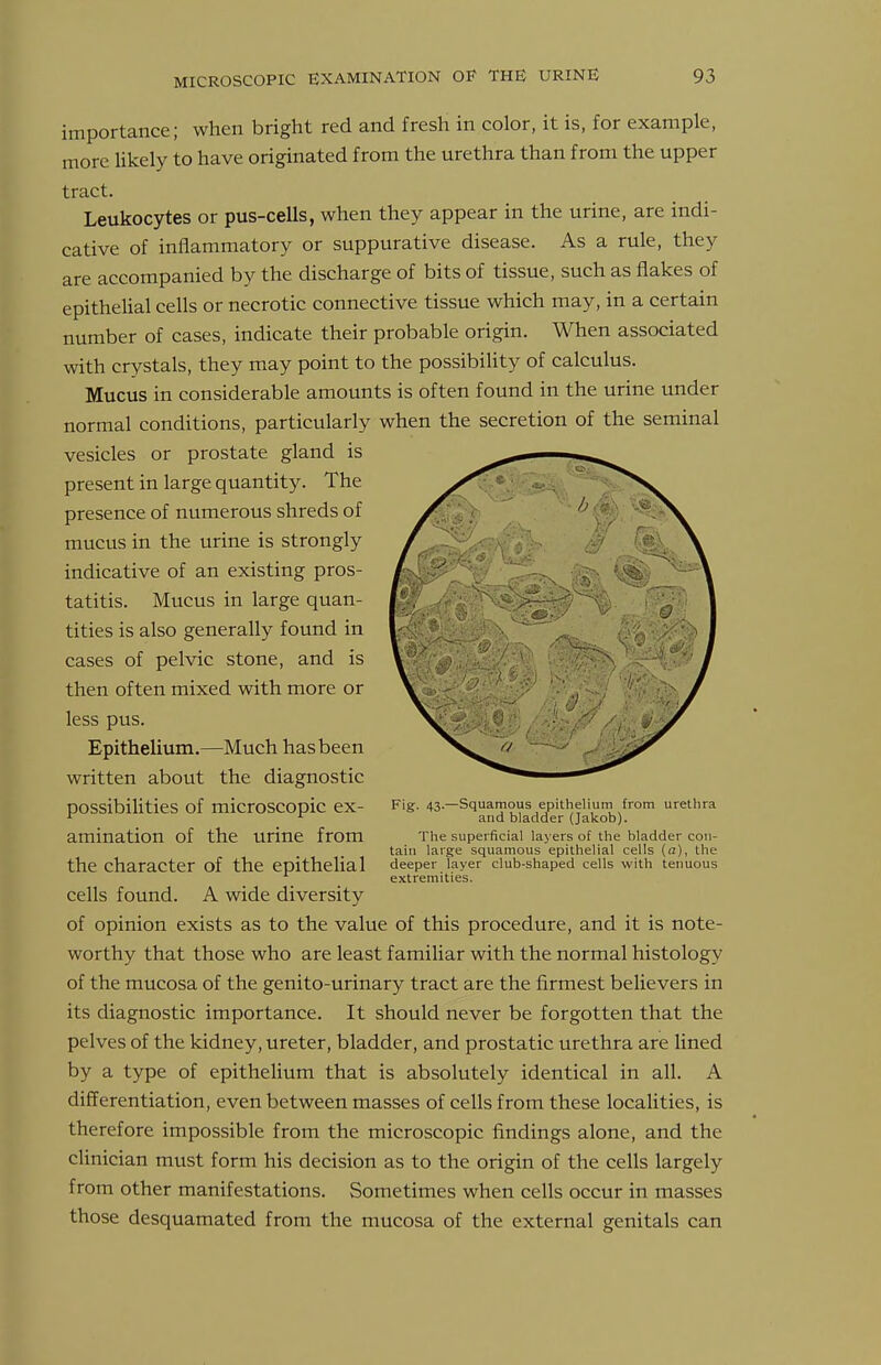 importance; when bright red and fresh in color, it is, for example, more likely to have originated from the urethra than from the upper tract. Leukocytes or pus-cells, when they appear in the urine, are indi- cative of inflammatory or suppurative disease. As a rule, they are accompanied by the discharge of bits of tissue, such as flakes of epithelial cells or necrotic connective tissue which may, in a certain number of cases, indicate their probable origin. When associated with crystals, they may point to the possibility of calculus. Mucus in considerable amounts is often found in the urine under normal conditions, particularly when the secretion of the seminal vesicles or prostate gland is present in large quantity. The presence of numerous shreds of mucus in the urine is strongly indicative of an existing pros- tatitis. Mucus in large quan- tities is also generally found in cases of pelvic stone, and is then often mixed with more or less pus. Epithelium.—Much has been written about the diagnostic possibilities of microscopic ex- amination of the urine from the character of the epithelial deeper Tayer'club-shaped cells with tenuous extremities. cells found. A wide diversity of opinion exists as to the value of this procedure, and it is note- worthy that those who are least familiar with the normal histology of the mucosa of the genito-urinary tract are the firmest believers in its diagnostic importance. It should never be forgotten that the pelves of the kidney, ureter, bladder, and prostatic urethra are lined by a type of epithelium that is absolutely identical in all. A differentiation, even between masses of cells from these localities, is therefore impossible from the microscopic findings alone, and the clinician must form his decision as to the origin of the cells largely from other manifestations. Sometimes when cells occur in masses those desquamated from the mucosa of the external genitals can Fig- 43-—Squamous epithelium from urethra and bladder (Jakob). The superficial layers of the bladder con- tain large squamous epithelial cells (a), the