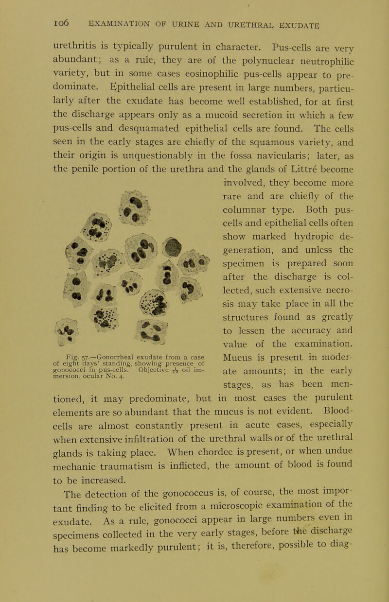 urethritis is typically purulent in character. Pus-cells are very abundant; as a rule, they are of the polynuclear neutrophilic variety, but in some cases eosinophilic pus-cells appear to pre- dominate. EpitheUal cells are present in large numbers, particu- larly after the exudate has become well established, for at first the discharge appears only as a mucoid secretion in which a few pus-cells and desquamated epithelial cells are found. The cells seen in the early stages are chiefly of the squamous variety, and their origin is unquestionably in the fossa navicularis; later, as the penile portion of the urethra and the glands of Littre become involved, they become more rare and are chiefly of the columnar type. Both pus- cells and epithelial cells often show marked hydropic de- generation, and unless the specimen is prepared soon after the. discharge is col- lected, such extensive necro- sis may take place in all the structures found as greatly to lessen the accuracy and value of the examination. Mucus is present in moder- ate amounts; in the early stages, as has been men- tioned, it may predominate, but in most cases the purulent elements are so abundant that the mucus is not evident. Blood- cells are almost constantly present in acute cases, especially when extensive infiltration of the urethral walls or of the urethral glands is taking place. When chordee is present, or when undue mechanic traumatism is inflicted, the amount of blood is found to be increased. The detection of the gonococcus is, of course, the most impor- tant finding to be elicited from a microscopic examination of the exudate. As a rule, gonococci appear in large numbers even in specimens collected in the very early stages, before the discharge has become markedly purulent; it is, therefore, possible to diag- Fig- 57-—Gonorrheal exudate from a case of eight days' standing, showing presence of gonococci in pus-cells. Objective oil im- mersion, ocular No. 4.
