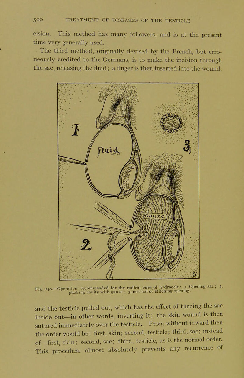 cision. This method has many followers, and is at the present time very generally used. The third method, originally devised by the French, but erro- neously credited to the Germans, is to make the incision through the sac, releasing the fluid; a fmger is then inserted into the wound. Fie 2do-Operation recommended for the radical cure of hydrocele: i, Opening sac; 2, packing cavity with gauze ; 3, method of stitchmg opennig. and the testicle pulled out, which has the effect of turning the sac inside out—in other words, inverting it; the skin wound is then sutured immediately over the testicle. From without inward then the order would be: first, skin; second, testicle; third, sac; instead of—first, skin; second, sac; third, testicle, as is the normal order. This procedure almost absolutely prevents any recurrence of