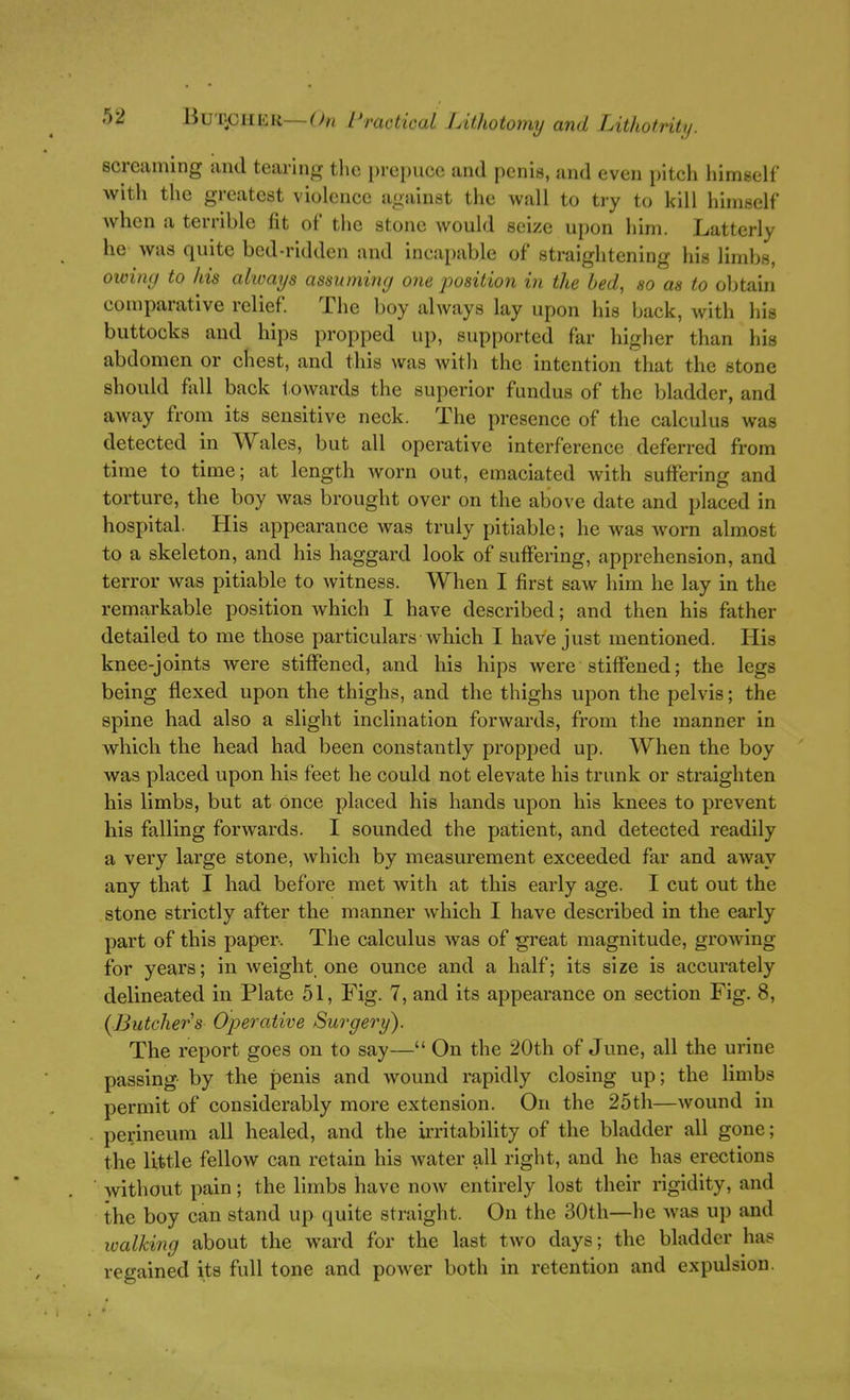 screaming and tearing tlie prepuce and penis, and even pitch himself with the greatest violence against the wall to try to kill himself when a terrible fit of the stone would seize upon him. Latterly he was quite bed-ridden and incapable of straightening his limbs, owing to his always assuming one position in the bed, so as to obtain comparative relief The boy always lay upon his back, with his buttocks and hips propped up, supported far higher than his abdomen or chest, and this was witli the intention that the stone should fiiU back towards the superior fundus of the bladder, and away from its sensitive neck. The presence of the calculus was detected in Wales, but all operative interference deferred from time to time; at length Avorn out, emaciated with suffering and torture, the boy was brought over on the above date and placed in hospital. His appearance was truly pitiable; he was worn almost to a skeleton, and his haggard look of suffering, apprehension, and terror was pitiable to witness. When I first saw him he lay in the remarkable position which I have described; and then his father detailed to me those particulars which I have just mentioned. His knee-joints were stiffened, and his hips were stiffened; the legs being flexed upon the thighs, and the thighs upon the pelvis; the spine had also a slight inclination forwards, from the manner in which the head had been constantly propped up. When the boy was placed upon his feet he could not elevate his trunk or straighten his limbs, but at once placed his hands upon his knees to prevent his falling forwards. I sounded the patient, and detected readily a very large stone, which by measurement exceeded far and away any that I had before met with at this early age. I cut out the stone strictly after the manner which I have described in the early part of this paper. The calculus was of great magnitude, growing for years; in weight one ounce and a half; its size is accurately delineated in Plate 51, Fig. 7, and its appearance on section Fig. 8, {■Butchers OiJerative Swgery). The report goes on to say— On the 20th of June, all the urine passing by the penis and wound rapidly closing up; the limbs permit of considerably more extension. On the 25th—wound in perineum all healed, and the irritability of the bladder all gone; the little fellow can retain his water all right, and he has erections without pain; the limbs have now entirely lost their rigidity, and the boy can stand up quite straight. On the 30th—he was up and walking about the ward for the last two days; the bladder has regained its full tone and power both in retention and expulsion.