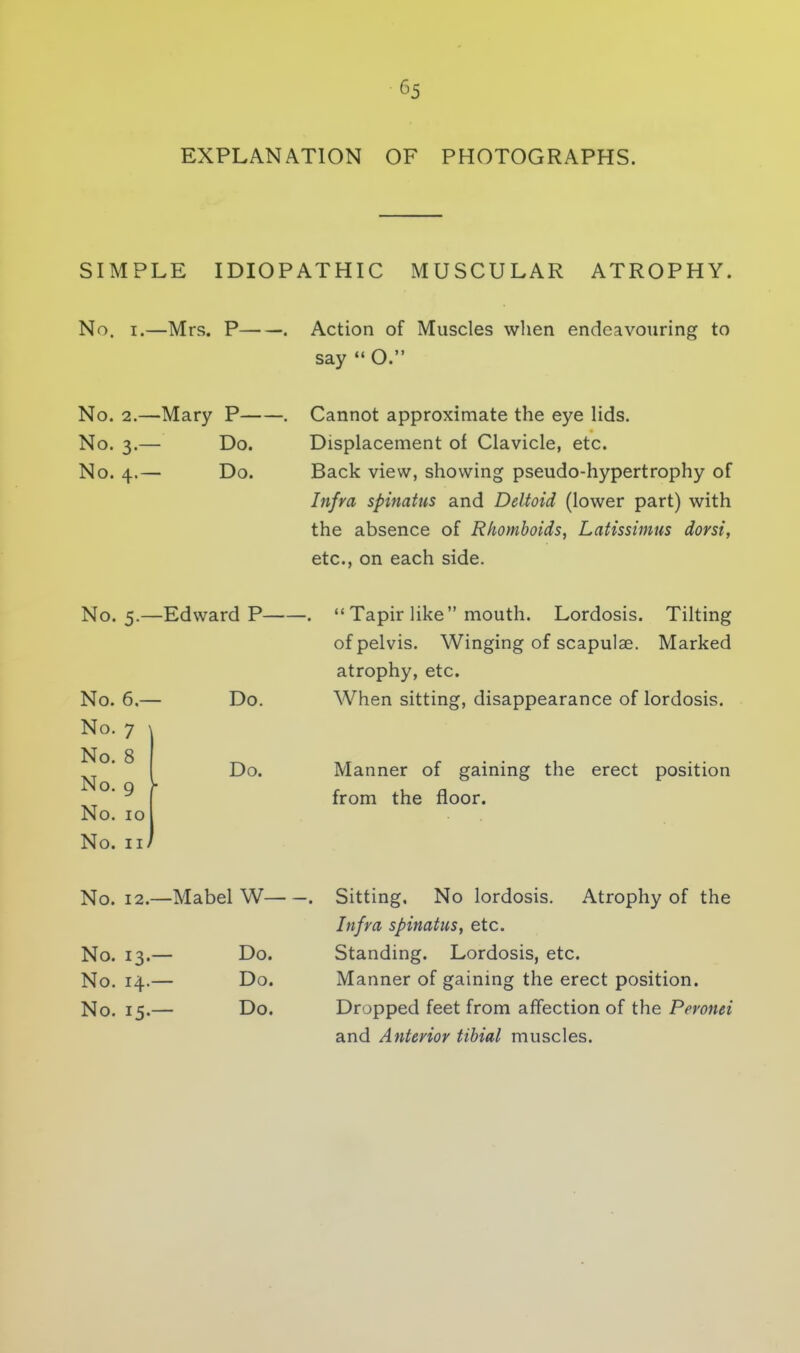 EXPLANATION OF PHOTOGRAPHS. SIMPLE IDIOPATHIC MUSCULAR ATROPHY. No. i.—Mrs. P . Action of Muscles when endeavouring to say O. No. 2.—Mary P . No. 3.— Do. No. 4.— Do. Cannot approximate the eye lids. Displacement of Clavicle, etc. Back view, showing pseudo-hypertrophy of Infra spinatus and Deltoid (lower part) with the absence of Rhomboids, Latissimus dorsi, etc., on each side. No. 5.—Edward P . No. 6.— No. 7 \ No. 8 No. 9 No. 10 No. 11) Do. Do. Tapir like mouth. Lordosis. Tilting of pelvis. Winging of scapulae. Marked atrophy, etc. When sitting, disappearance of lordosis. Manner of gaining the erect position from the floor. No. 12—Mabel W . No. 13.— No. 14.— No. 15.— Do. Do. Do. Sitting. No lordosis. Atrophy of the Infra spinatus, etc. Standing. Lordosis, etc. Manner of gaining the erect position. Dropped feet from affection of the Peronei and Anterior tibial muscles.