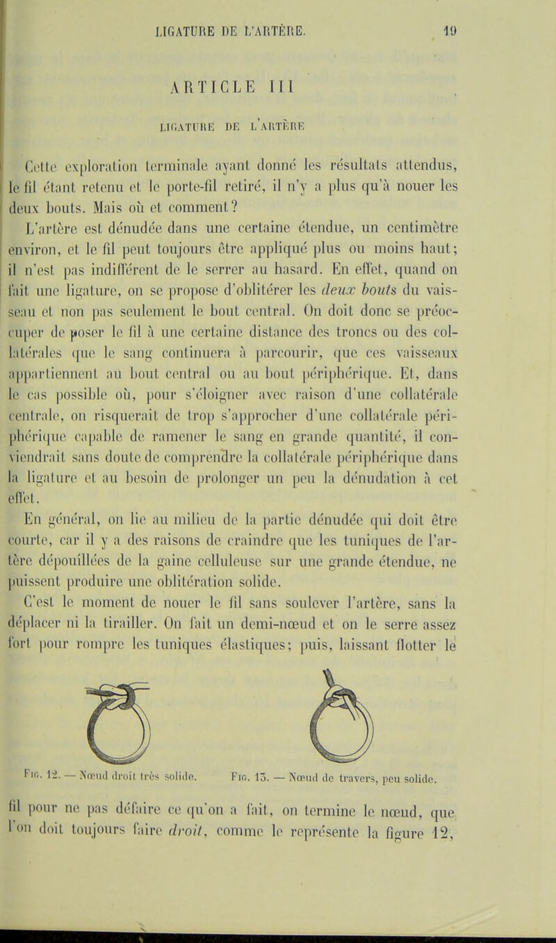 ARTICLE III LIGATURE DE LARTÈRE Cette exploration terminale ayant donné les résultats attendus, le lil étant retenu et le porte-fil retiré, il n'y a plus qu'à nouer les deux bouts. Mais où et comment? L'artère est dénudée dans une certaine étendue, un centimètre environ, et le fil peut toujours être appliqué plus ou moins haut; il n'est pas indifférent de le serrer au hasard. En effet, quand on fait une ligature, on se propose d'oblitérer les deux bouts du vais- seau et non pas seulement le bout central. On doit donc se préoc- cuper de poser le li! à une certaine dislance des troncs ou des col- latérales que le sang continuera à parcourir, que ces vaisseaux appartiennent au bout central ou au bout périphérique. Et, dans le cas possible où, pour s'éloigner avec raison d'une collatérale centrale, on risquerait de trop s'approcher d'une collatérale péri- phérique capable de ramener le sang en grande quantité, il con- viendrait sans doute de comprendre la collatérale périphérique dans la ligature ei au besoin de prolonger un peu la dénudation à cet effet. En général, on lie au milieu de la partie dénudée qui doit être courte, car il y a des raisons de craindre que les tuniques de l'ar- tère dépouillées de la gaine celluleuse sur une grande étendue, ne puissent produire une oblitération solide. C'est le moment de nouer le fil sans soulever l'artère, sans la déplacer ni la tirailler. On fait un demi-nœud et on le serre assez tort pour rompre les tuniques élastiques; puis, laissant flotter le Fir,. 12. _ Nœud droit très solide. Fio. lô. — Nœud de travers, peu solide. 'il pour ne pas défaire ce qu'on a fait, on termine le nœud, que l'on doit toujours l'aire droit, comme le représente la figure ï%