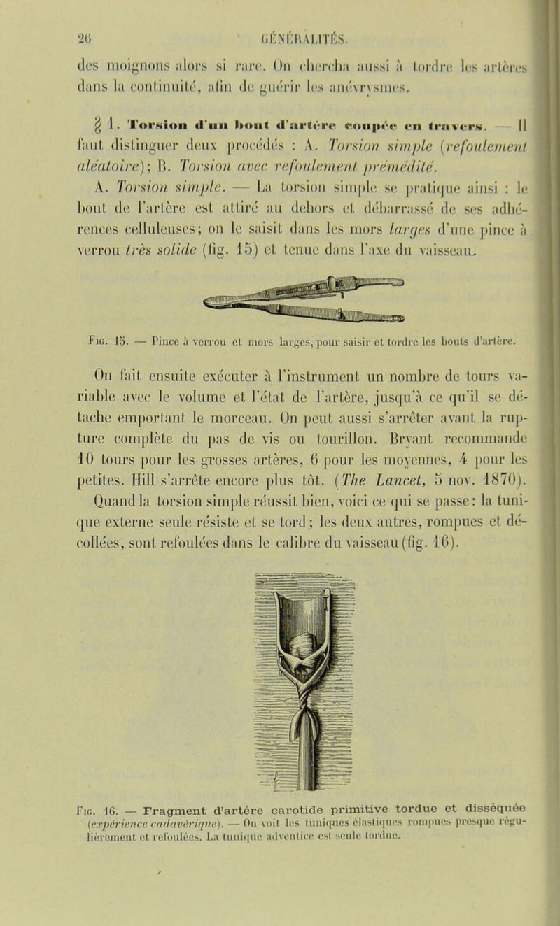 des moignons alors si rare, On chercha aussi à tordre les artères dans la continuité, afin de guérir les anévrysmes, I. Torsion «l'un houi d'artère eoupée <*n travers. faut distinguer deux procédés : A. Torsion simple [refoulement aléatoire); \\. Torsion avec refoulement prémédité. A. Torsion simple. — La torsion simple se pratique ainsi : le boni, de l'artère est attiré au dehors et débarrassé de ses adhé- rences celluleuses; on le saisit dans les mors larges d'une pince à verrou très solide (fig. 15) et tenue dans l'axe du vaisseau. Fiu. 15. — Pince à verrou cl mors larges, pour saisir et tordre les bouts d'artère. On fait ensuite exécuter à l'instrument un nombre de tours va- riable avec le volume et l'état de l'artère, jusqu'à ce qu'il se dé- tache emportant le morceau. On peut aussi s'arrêter avant la rup- ture complète du pas de vis ou tourillon. Bryanl recommande 10 tours pour les grosses artères, 6 pour les moyennes, \ pour les petites. Hill s'arrête encore plus tôt. (The Lancet, 5 nov. 1870). Quand la torsion simple réussit bien, voici ce qui se passe : la tuni- que externe seule résiste et se tord ; les deux autres, rompues cl dé- collées, sont refoulées dans le calibre du vaisseau (fig. 16). Fig. 16. — Fragment d'artère carotide primitive tordue et disséquée {expérience cadavérique). — Ou voit les tuniques élastiques rompues presque régu- lièrement et refoulées. La (unique adventice est seule tordue.