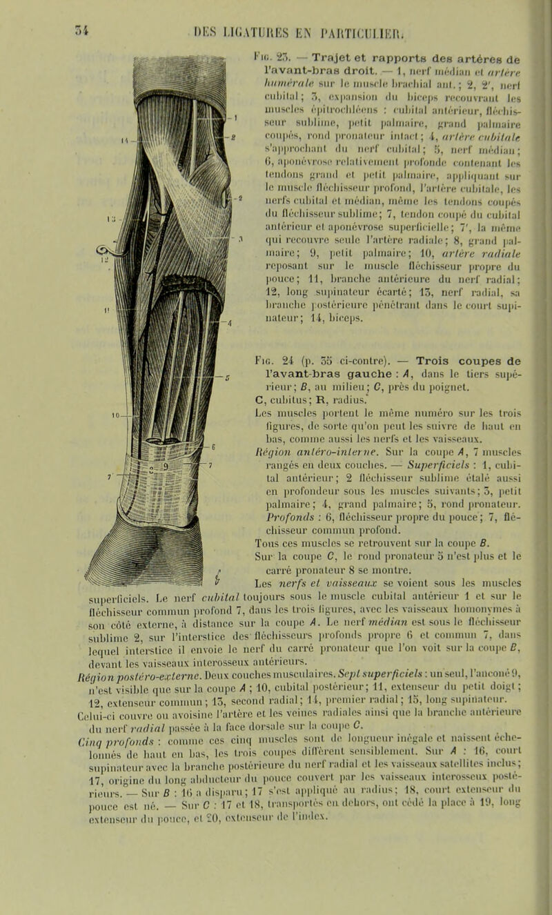 F». 25, — Trajet et rapports des artères de l'avant-bras droit. — 1, nerf médian et artère lut niera le sur lu muscle brachial nul.; 2, 2', mil Cubital; 3, expansion du biceps recouvrant les muscles épilrochléens : Cllbiial antérieur, flechii- seur sublime, petit palmaire, grand palmaire coupés, rond pronaleur intact ; i, artère Cubitale s'approrhaii! du nerf cubital; 5, nerf médian; 6, aponévrose relativement profonde contenant les tendons grand et petit palmaire, appliquant sur le muscle fléchisseur profond, Tarière cubitale, les nerfs cubital et médian, même les tendons coupés du fléchisseur sublimé; 7, tendon coupé du cubital antérieur et aponévrose superficielle; 7', la même qui recouvre seule l'artère radiale; 8, grand pal- maire; <J, petit palmaire; 10, artère radiale reposant sur le muscle fléchisseur propre du pouce; 11, branche antérieure du nerf radial: 12, long supinatcur écarté; 13, nerf radial, sa branche postérieure pénétrant dans le court supi- uateùr; 14, biceps. Fie. 2i (p. 55 ci-contre). — Trois coupes de l'avant-bras gauche : A, dans le tiers supé- rieur; B, au milieu ; C, près du poignet. C, cubitus; R, radius. Les muscles portent le même numéro sur les trois ligures, de sorte qu'on peut les suivre de haut en bas, comme aussi les nerfs et les vaisseaux. Région nnléro-inlerne. Sur la coupe A, 7 muscles rangés en deux couches. — Superficiels : 1, cubi- tal antérieur; 2 fléchisseur sublime étalé aussi en profondeur sous les muscles suivants; ô, petit palmaire; i, grand palmaire; 5, rond pronateur. Profonds : 6, fléchisseur propre du pouce ; 7, flé- chisseur commun profond. Tous ces muscles se retrouvent sur la coupe B. Sur la coupe C, le rond pronateur 5 n'est plus et le carré pronateur 8 se montre. Les nerfs el vaisseaux se voient sous les muscles superficiels. Le nerf cubital toujours sous le muscle cubital antérieur 1 et sur le fléchisseur commun profond 7, dans les trois ligures, avec les vaisseaux homonymes à son coté externe, à distance sur la coupe A. Le nerf médian esl sous le fléchisseur sublime 2, sur l'interstice des fléchisseurs profonds propre 6 et commun 7, dans lequel interstice il envoie le nerf du carré pronateur que l'on voit sur la coupe C, devant les vais-eaux interosseux antérieurs. Région postéro-e.vlerne. Deux couches musculaires. Sept superficiels : un seul, CancanéQ, n'est visible que sur la coupe A ; 10, cubital postérieur; 11, extenseur du petit doigl ; 12, extenseur commun; 15, second radial; 11, premier radial ; 15, long snpinateur. Celui-ci couvre ou avoisine l'artère et les veines radiales ainsi que la branche antérieure du nerf radial passée à la face dorsale sur la coupe C. Cinq profonds : comme ces cinq muscles sont de longueur inégale et naissent éche- lonnés de haut eu bas, les trois coupes diffèrent sensiblement. Sur A : 16. court supinatcur avec la branche postérieure du nerf radial el les vaisseaux satellites inclus; 17, origine du long abducteur du pouce couvert par les vaisseaux interosseux posté- rieurs.0— Sur B : 10 a disparu; 17 s'est appliqué au radius; 1S. court extenseur du pouce est né. — Sur C : 17 et. 18, transportés eu dehors, ont cédé la place à 19, long extenseur iln ponce, el 20, extenseur de l'index.