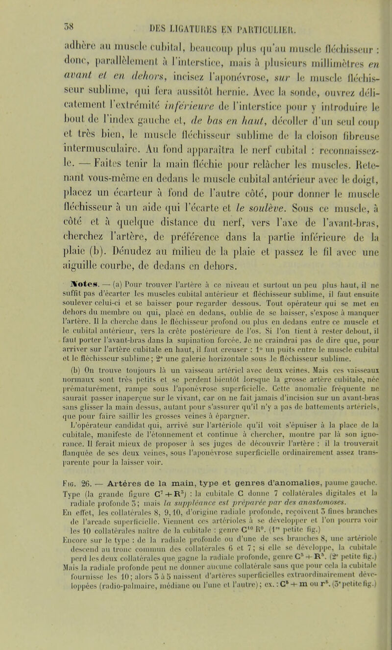 adhère au muscle cubital, beaucoup plus qu'au muscle fléchisseur : donc, parallèlement à l'interstice, mais à plusieurs millimètres en avant et en dehor*, incisez l'aponévrose, sur le muscle lléchis- seur sublime, qui fera aussitôt hernie. Avec la sonde, ouvrez déli- catement l'extrémité inférieure de l'interstice pour y introduire le bout de l'index «-anche et, de bas en haut, décoller d'un seul coup et très bien, le muscle fléchisseuV Sublime de la cloison (ihreuse intermusculàire. Au fond apparaîtra le nerf cubital : reconnaissez- le. — Faites tenir la main fléchie pour relâcher les muscles. Rete- nant vous-même en dedans le muscle cubital antérieur avec ledoi''t, placez un écarteur à fond de l'autre côté, pour donner le muscle fléchisseur à un aide qui l'écarté et le soulève. Sous ce muscle, à coté et à quelque distance du nerf, vers l'axe de l'avant-bras, cherchez l'artère, de préférence dans la partie inférieure de la plaie (h). Dénudez au milieu de la plaie et passez le (il avec une aiguille courbe, de dedans eu dehors. JWotes. — (a) Pour trouver l'artère à ce niveau et surtout un peu plus haut, il ne suffit pas d'écarter les muscles cubital antérieur et fléchisseur sublime, il faut ensuile soulever celui-ci et se baisser pour regarder dessous. Tout opérateur qui se met en dehors du membre ou qui, placé eu dedans, oublie de se baisser, s'expose à manquer l'artère. Il la cherche dans le fléchisseur profond ou plus en dedans entre ce muscle et le cubital antérieur, vers la crête postérieure de l'os. Si l'on lient à rester debout, il faul porter l'avant-bras dans la supination forcée. Je ne craindrai pas de dire que, pour arriver sur l'artère cubitale en haut, il faut creuser : 1° un puits entre le muscle cubital et le fléchisseur sublime; 2° une galerie horizontale sous le fléchisseur sublime. (b) On trouve toujours là un vaisseau artériel avec deux veines. Mais ces vaisseaux normaux sont très petits et se perdent bientôt lorsque la grosse artère cubitale, née prématurément, rampe sous l'aponévrose superficielle. Celle anomalie fréquente ne saurait passer inaperçue sur le vivant, car on ne fait jamais d'incision sur un avant-bras sans glisser la main dessus, aulant pour s'assurer qu'il n'y a pas de battement? artériels, que pour faire saillir les grosses veines à épargner. L'opérateur candidat qui, arrivé sur l'artériole qu'il voit s'épuiser à la place de la cubitale, manifeste de l'étonnemenl et. continue à chercher, montre par là son igno- rance. Il ferait mieux de proposer à ses juges de découvrir l'artère : il la trouverait flanquée de ses deux veines, sous l'aponévrose superficielle ordinairement assez trans- parente pour la laisser voir. Fig. 26. — Artères de la main, type et genres d'anomalies, paume gauche. Type (la grande ligure C7-»-!^ : la cubitale C donne 7 collatérales digitales et la radiale profonde ô; mais la Stippléancè est préparée par des anastumoses. En cll'et, les collatérales 8, 9,10, d'origine radiale profonde, reçoivent 3 fines branches de l'arcade superficielle. Viennent ces arlérioles à se développer et l'on pourra voir tes 10 collatérales naître de la cubitale : genre C H. (1 petite fig.) Encore sur le type : de la radiale profonde ou d'une de ses branches 8, une artériole descend au tronc commun des collatérales fi et 7; si elle se développe, la cubitale perd les deux collatérales que gagne la radiale profonde, genre Cn-+-RR. petite lig.) Mais la radiale profonde peut ne donner aucune collatérale sans que pour cela la cubitale fournisse les 10; alors 3 à 5 naissent d'artères superficielles extraordinairement déve- loppées (radio-palmaire, médiane ou l'une et l'autre); ex. : C* -+- m ou rs. (5* petite fig.)