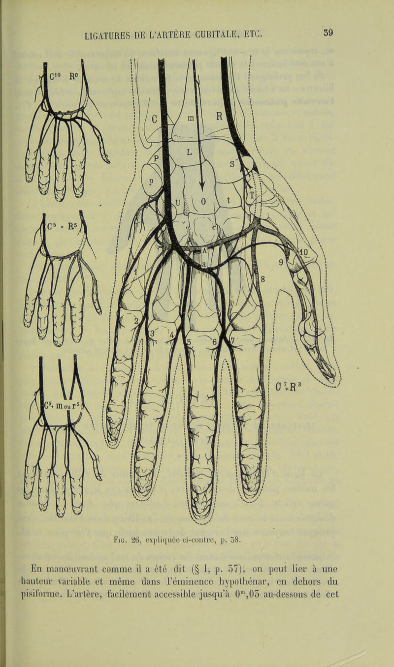 Fig. 26, expliquée ci-contre, p. 08. En manœuvrant comme il a été dit (§ I, p. 57), on peul lier à une hauteur variable et même dans l'éminence hypothénar, en dehors du pisiforme. L'artère, facilement accessible jusqu'à 0',05 an-dessous de cet