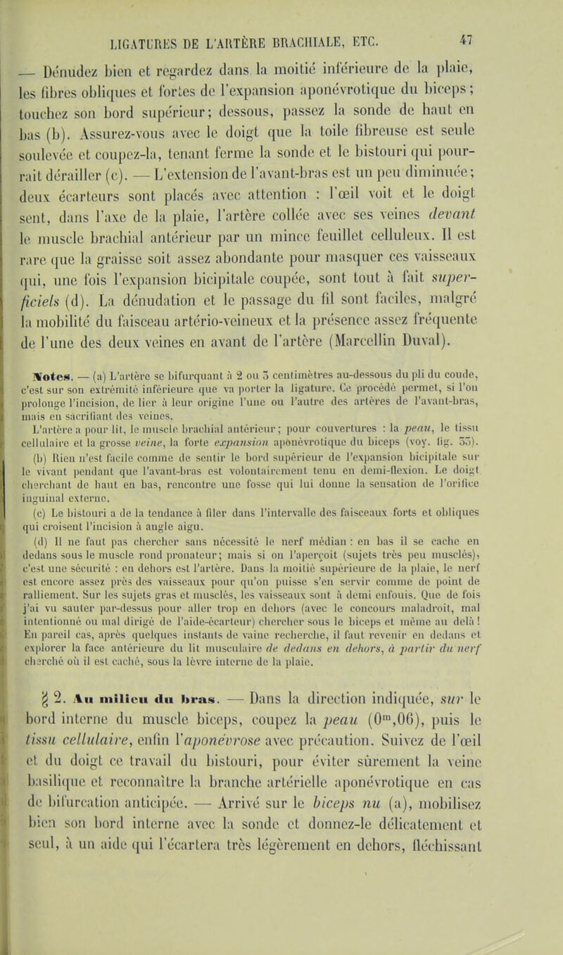 Dénudez bien et regardez dans la moitié inférieure de la plaie, tes ûbrès obliques et fortes de l'expansion àponévro tique du biceps; bûchez son bord supérieur; dessous, passez la sonde de haut en bas (b). Assurez-vous avec le doigt que la toile fibreuse est seule soulevée et coupez-la, tenant Terme la sonde et le bistouri qui pour- rait dérailler (c). — L'extension de l'avant-bras est un peu diminuée; deux écarteurs sont placés avec attention : l'œil voit et le doigt seul, dans l'axe de la plaie, l'artère collée avec ses veines devant \v muscle brachial antérieur par un mince feuillet celluleux. Il est rare que la graisse soit assez abondante pour masquer ces vaisseaux nui, une fois l'expansion bicipitale coupée, sont tout à fait super- ficiels (d). La dénudation et le passage du fd sont faciles, malgré la mobilité du faisceau artério-veineux et la présence assez fréquente de l'une des deux veines en avant de l'artère (Marcellin Duval). Vote* - - (a) L'artère se bifurquant à 2 ou T, centimètres au-dessous du pli du coude, c'est sur son extrémité inférieure que va porter la ligature. Ce procédé permet, si l'on prolonge l'incision, de lier à leur origine l'une ou l'autre des artères de l'avant-bras, mais eu sacrifiant des veines. L'artère a pourlil, le muscle brachial antérieur; pour couvertures : la peau, le tissu cellulaire et la grosse veine, la forte expansion apouèvrotique du biceps (voy. lig. 55). (b) Rien n'est facile comme de sentir le boni supérieur de l'expansion bicipitale mu- le vivant pendant que l'avant-bras est volontairement tenu en demi-flexion. Le doigt cherchant de liant en bas, rencontre une fosse qui lui donne la sensation de l'orifice inguinal externe. (c) Le bistouri a de la tendance à filer dans l'intervalle des faisceaux forts et obliques qui croisent l'incision à augle aigu. (d) Il ne faut pas chercher sans nécessité le nerf médian : en bas il se cache ni dedans sous le muscle rond pronatcur; mais si ou l'aperçoit (snjels liés peu musclés), c'est une sécurité. : en dehors est l'artère. Dans la moitié supérieure de la plaie, le nerf psi encore assez près des vaisseaux pour qu'on puisse s'en servir comme de point de ralliement. Sur les sujets gras et musclés, les vaisseaux sont à demi enfouis. Que de fois j'ai vu sauter par-dessus pour aller trop en dehors (avec le concours maladroit, mal intentionné ou mal dirigé de l'aide-écarteur) chercher sous le biceps et même au delà ! Km pareil cas. après quelques instants de vaine recherche, il faut revenir en dedans et explorer la face antérieure du lit musculaire de dedans en dehors, à partir du nerf cil irché où il est caché, sous la lèvre interne de la plaie. g 2. Au milieu du bras. — Dans la direction indiquée, sur le bord interne du muscle biceps, coupez la peau (0m,06), puis le fissu cellulaire, enfin l'aponévrose avec précaution. Suivez de l'œil et du doigt ce travail du bistouri, pour éviter sûrement la veine basilique et reconnaître la branche artérielle aponévrotique en cas de bifurcation anticipée. —■ Arrivé sur le biceps nu (a), mobilisez bien son bord interne avec la sonde et donnez-le délicatement et seul, à un aide qui l'écartera très légèrement en dehors, fléchissant