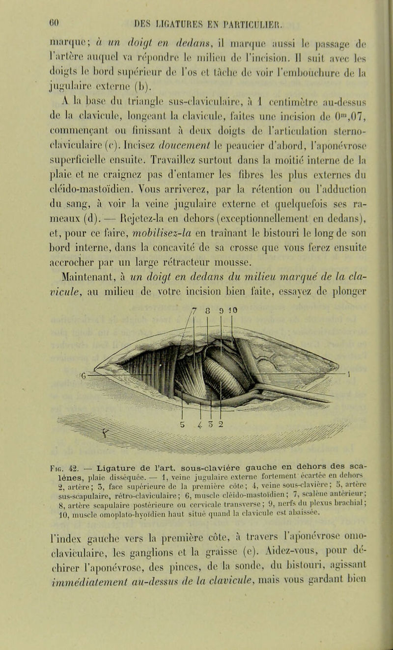 marque; à un doigt en dedans, il marque aussi le passage de l'artère auquel va répondre le milieu de l'incision. Il suit avec les doigts le bord supérieur de l'os et tâche de voir l'embouchure de la jugulaire externe (b). A la base du triangle sus-claviculaire, à 1 centimètre au-dessus de la clavicule, longeant la clavicule, faites une incision de 0m,07, commençant ou finissant à deux doigts de l'articulation sterno- ohïvicùlaire (c). Incisez doucement le peàucier d'abord, l'aponévrose superficielle ensuite. Travaillez surtoul dans la moitié interne de la plaie et ne craignez pas d'entamer les fibres les plus externes du cléido-mastoïdien. Vous arriverez, par la rétention ou l'adduction du.sang, à voir la veine jugulaire externe et quelquefois ses ra- meaux (d).— RejetezJa en dehors (exceptionnellement en dedans), et, pour ce l'aire, mobilisez-la en traînant le bistouri le long de son bord interne, dans la concavité de sa crosse que vous ferez ensuite accrocher par un large rétracteur mousse. Maintenant, à un doigt en dedans du milieu marqué de la cla- vicule, au milieu de votre incision bien faite, essayez de plonger Fie. 4-2. — Ligature de l'art, sous-claviére gauche en dehors des sca- lènes, plaie disséquée.— 1, veino jugulaire,externe fortement écartée en dehors 2, artère; 5, face supérieure de la première cote; 4, veinesous-clavière; 5, artère siis-scapulaire, rétro-claviculaire; 6, muscle cléido-mastoïdien; 7, scalène antérieur: 8, artère scapulaire postérieure ou cervicale transverse; 9, nerfs du plexus brachial ; 10, muscle omoplato-hyoïdien haut situé quand la clavicule esl abaissée. l'index gauche vers la première cote, à travers l'aponévrose omo- clavicuïaire, les ganglions et la graisse (e). Aidez-vous, pour dé- chirer l'aponévrose, des pinces, de la sonde, du bistouri, agissan! immédiatement ail-dessus de la clavicule mais vous gardant bien