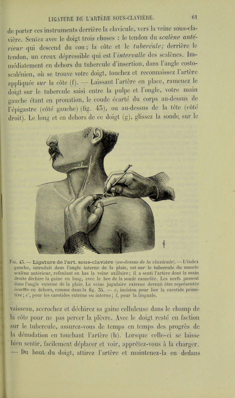,1». parler ces instruments derrière la clavicule, vers la veine sous-cla- nère. Sentez avec le doigt trois choses : le tendon du scalène anté- rieur qui descend du cou; la cote et le tubercule; derrière le tendon, un creux dépressible qui est ['intervalle des scalènes. Im- médiatement en dehors du tubercule d'insertion, dans l'angle eosto- scalénien, où se trouve votre doigt, touchez et reconnaissez l'artère appliquée sur la cote (f). — Laissant l'artère en place, ramenez le doigt sur le tubercule saisi entre la pulpe et l'ongle, votre main gauche étant en pronation, le coude écarté du corps au-dessus de l'épigastre (coté gauche) (fig. 45), ou au-dessus de la tête (côté droit). Le long et en dehors de ce doigt (g), glissez la sonde sur le Fn;. 13. — Ligature de l'art, sous-claviére [au-dessus de la clavicule).— blindes gauche, introduit dans l'angle interne de la plaie, est mir le tubercule iln muscle scaléue antérieur, refoulant eu bas la veine axillairc; il a senti l'artère dont la main droite déchire la gaine en long, avec le bec de la soude cannelée. Les nerfs passent dans l'angle externe de lu plaie. La veine jugulaire externe devraiI être représentée écartCe en dehors, comme dans la li^. 35. — c, incision pour lier la carotide primi- tive; c', pour les carotides externe ou interne; /. pour la linguale. vaisseau, accrochez et déchirez sa gaine celluleuse dans le champ de la cote pour ne pas percer la plèvre. Avec le doigt resté en l'action çur le tubercule, assurez-vous de temps en temps des progrès de la dénuda tion en louchant, l'artère (h). Lorsque celle-ci se laisse bien sentir, facilement déplacer et voir, apprêtez-vous à la charger. — Du bout, du doigt, attirez l'artère et maintenez-la en dedans
