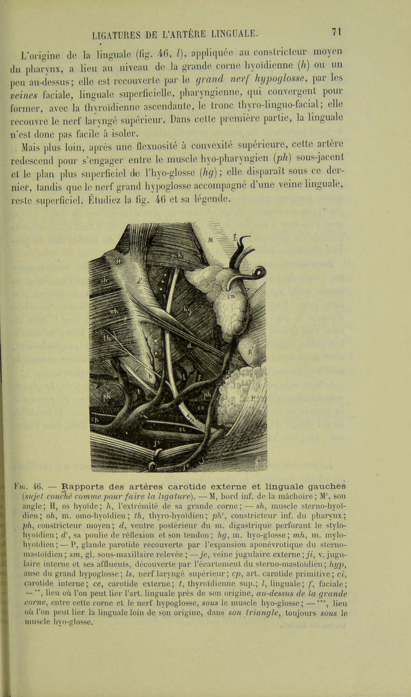 L'origine de la linguale (fig. 46, /). appliquée au eonstricteur moyen du pharynx, a lieu au niveau de la grande corne hyoïdienne (h) ou un peu au-dessus; elle esl recouverte par le grùnd nerf hypoglosse, par les reine* faciale, linguale superficielle, pharyngienne, qui convergent pour former, avec la thyroïdienne ascendante, le tronc thyro-linguo-facial; elle recouvre le nerf laryngé supérieur. Dans cette première partie, la linguale n'esl donc pas facile à isoler. Mais plus loin, après une ûexuosité à convexité supérieure, cette artère fedescend pour s'engager entre le muscle hvo-pliaryngien (ph) sous-jacenl ci le plan plus superficiel de l'hyo-glosse {kg); elle disparaît sous ce der- nier, tandis que le nerf grand hypoglosse accompagné d'une veine linguale, rcslc superficiel. Étudies! la fig. 46 et sa légende. Kiu. 16. — Rapports des artères carotide externe et linguale gauches (sujet couché comme pour faire la ligature), — M, bord inf, de la mâchoire; M', son initie; II, os hyoïde; h, l'extrémité de sa grande corne; - -sh, muscle sterno-hyoï- dien; oh, m. omo-hyoïdien; th, tliyro-hyoïdien; ph', constricteur inf. du pharynx; ph, constricteur moyen; d, ventre postérieur du m. digastrique perforant le stylor hyoïdien; d', sa poulie de réflexion et son tendon; h(j, ni. Iiyo-glosse; mh, m. mylo- liyoldien;—I', glande parotide recouverte par l'expansion aponèvrotique du storno- înasloïdien ; sm, gl. sous-maxillaire relevée ; —je, veine jugulaire externe ; ji, v. jugu- laire interne et ses affluents, découverte par l'écartoment du sierno-inasioidien ; hiyp, anse du grand hypoglosse; Is, nerf laryngé supérieur; cp, art. carotide primitive; ci, carotide interne; ce, carotide externe; t, thyroïdienne sup.; linguale; f, faciale; — ', lieu où l'on peut lier l'art, linguale près de son origine, au-dessus de la grande corne, entre cette corne et le nerf hypoglosse, SOUS le muscle hyo-glossc; —lieu où l'on peut lier la linguale loin de son origine, dans son triangle,, toujours sous le muscle hyo-glossc.