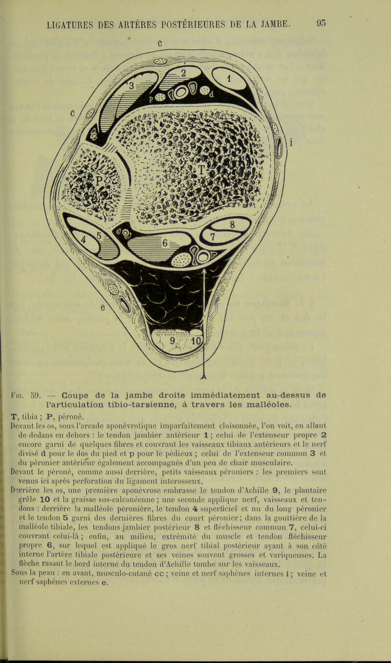 Fie. 'i9. — Coupe de la jambe droite immédiatement au-dessus de l'articulation tibio-tarsienne, à travers les malléoles. T, tibia ; P, péroné. Devant les os, sous l'arcade aponévrotique imparfaitement cloisonnée, l'on voit, en allant de dedans en dehors : le tendon jambier antérieur 1; celui de l'extenseur propre 2 encore garni de quelques fibres et couvrant les vaisseaux tibiaux antérieurs el le nerf divisé d pour le dos du pied et p pour le pédieux; celui de l'extenseur commun 3 et du péronier antérieur également accompagnés d'un peu de chair musculaire. Devant le péroné, comme aussi derrière, petits vaisseaux péroniers : les premiers sont venus ici après perforation du ligament interosseux. Derrière les os, une première aponévrose embrasse le tendon d'Achille 9, le plantaire grêle 10 et la graisse sus-calcanéeune ; une seconde applique nerf, vaisseaux et ten- dons : derrière la malléole péronière, le tendon 4superficiel el nu dulong péronier et le tendon 5 garni des dernières fibres du court péronier; dans la gouttière de la malléole tibiale, les tendons jambier postérieur 8 et fléchisseur commun 7, celui-ci couvranl celui-là ; enfin, au milieu, extrémité du muscle et tendon fléchisseur propre 6, sur lequel est appliqué le gros nerf tibia! postérieur ayant à son côté interne l'artère tibiale postérieure et ses veines souvent grosses et variqueuses. La llèche rasant le bord interne du tendon d'Achille tombe sur les vaisseaux. Sous la peau : en avant, musculo-cutané ce ; veine et nerf saphènes internes i ; veine et nerf saphènes externes e.